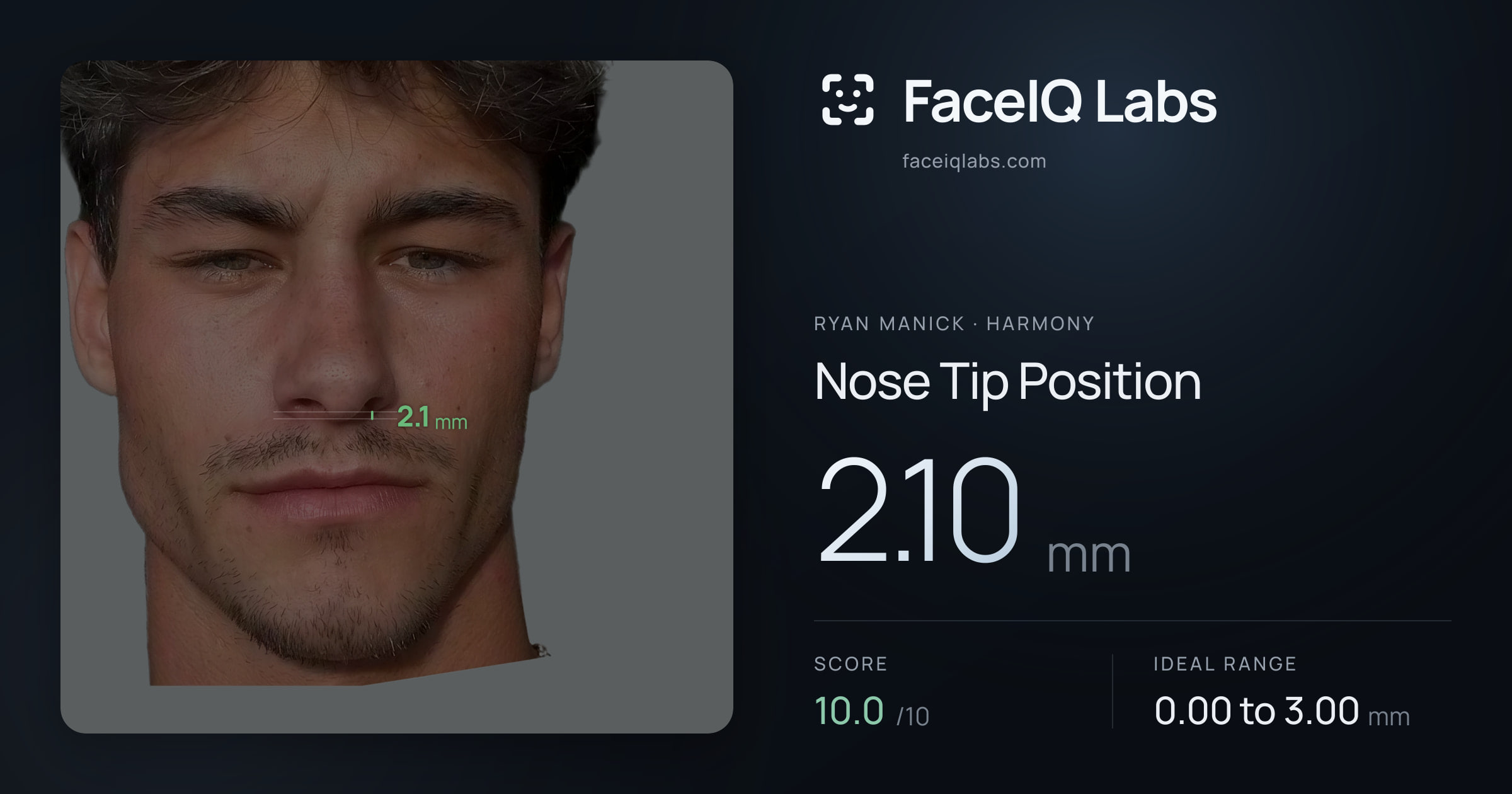 Ryan Manick Nose Tip Position: 2.10mm, drawn on the photo