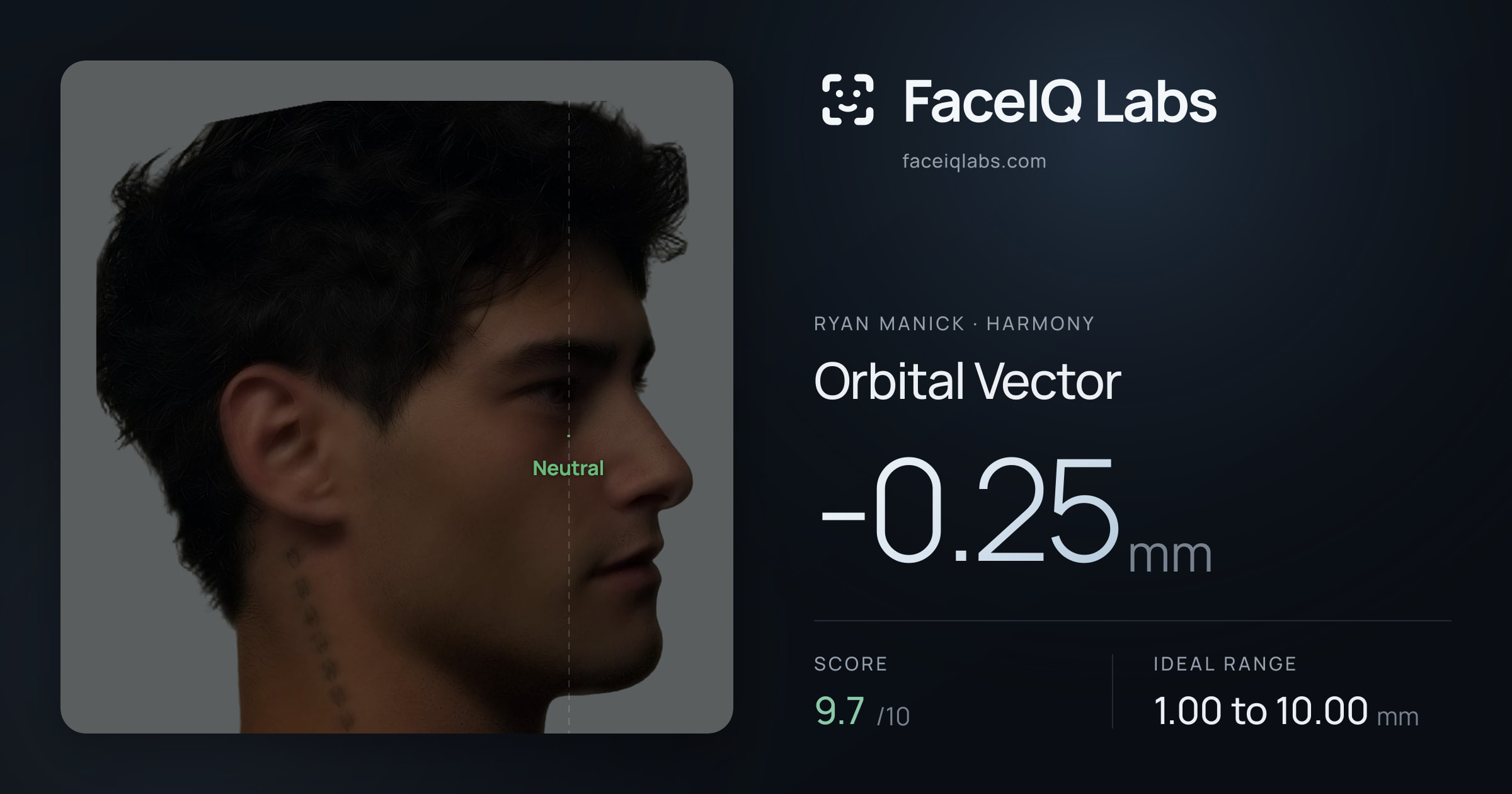 Ryan Manick Orbital Vector: -0.25mm, drawn on the photo