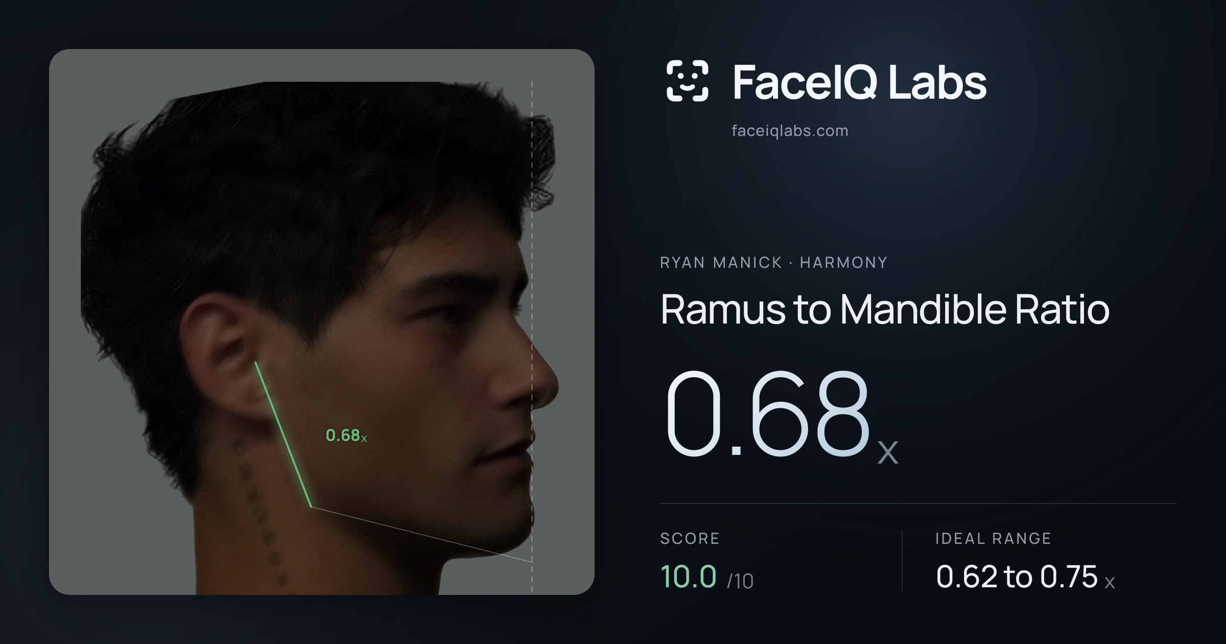 Ryan Manick Ramus to Mandible Ratio: 0.68x, drawn on the photo