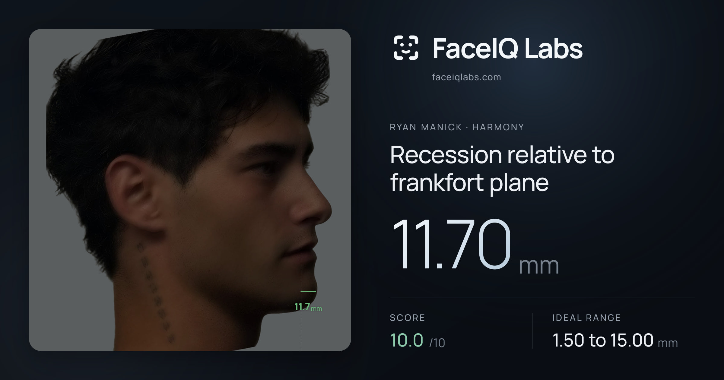 Ryan Manick Recession relative to frankfort plane: 11.70mm, drawn on the photo