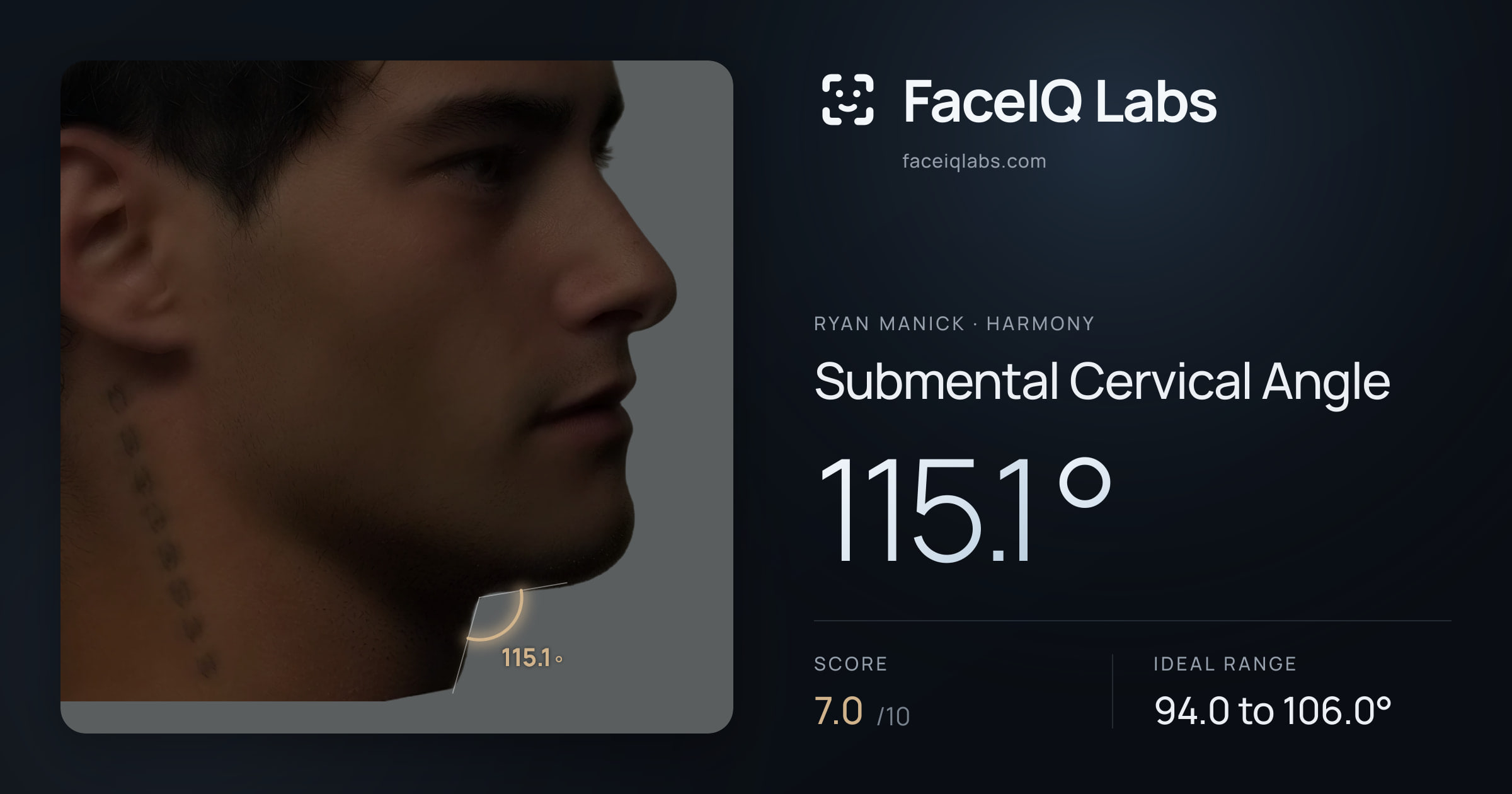 Ryan Manick Submental Cervical Angle: 115.1°, drawn on the photo