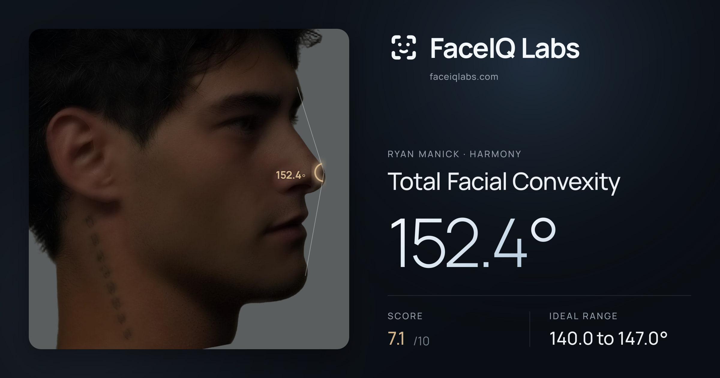 Ryan Manick Total Facial Convexity: 152.4°, drawn on the photo