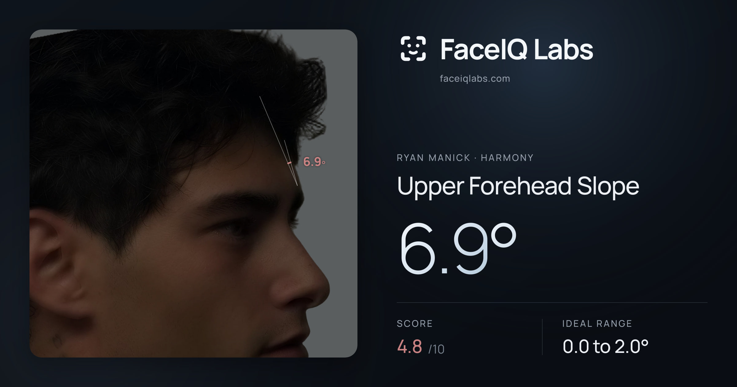 Ryan Manick Upper Forehead Slope: 6.9°, drawn on the photo