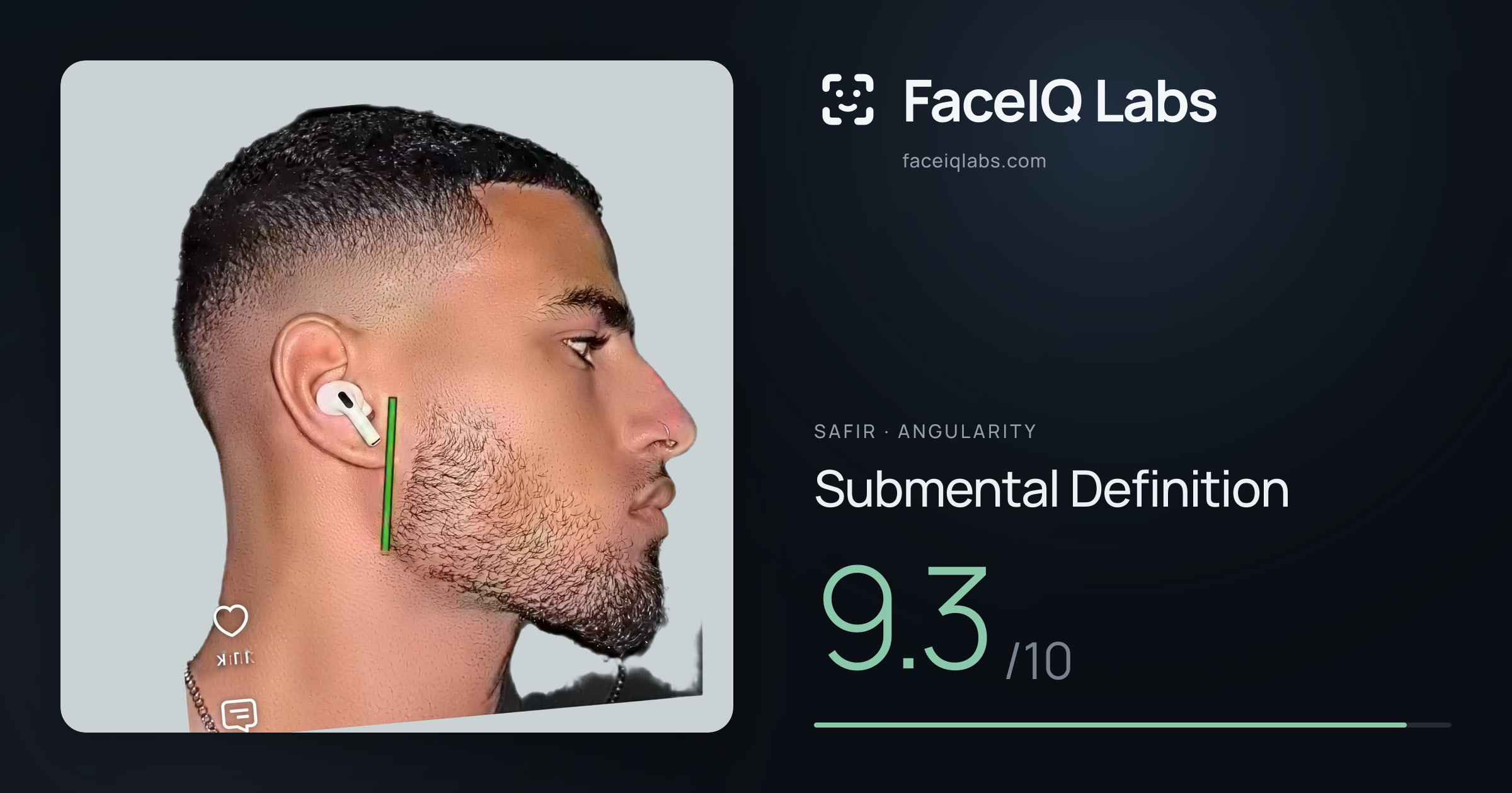 Safir Submental Definition: 9.3/10, drawn on the photo