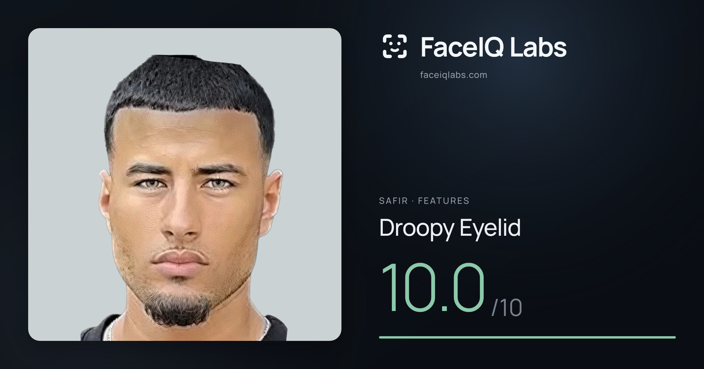 Safir Droopy Eyelid: 8.5/10, drawn on the photo