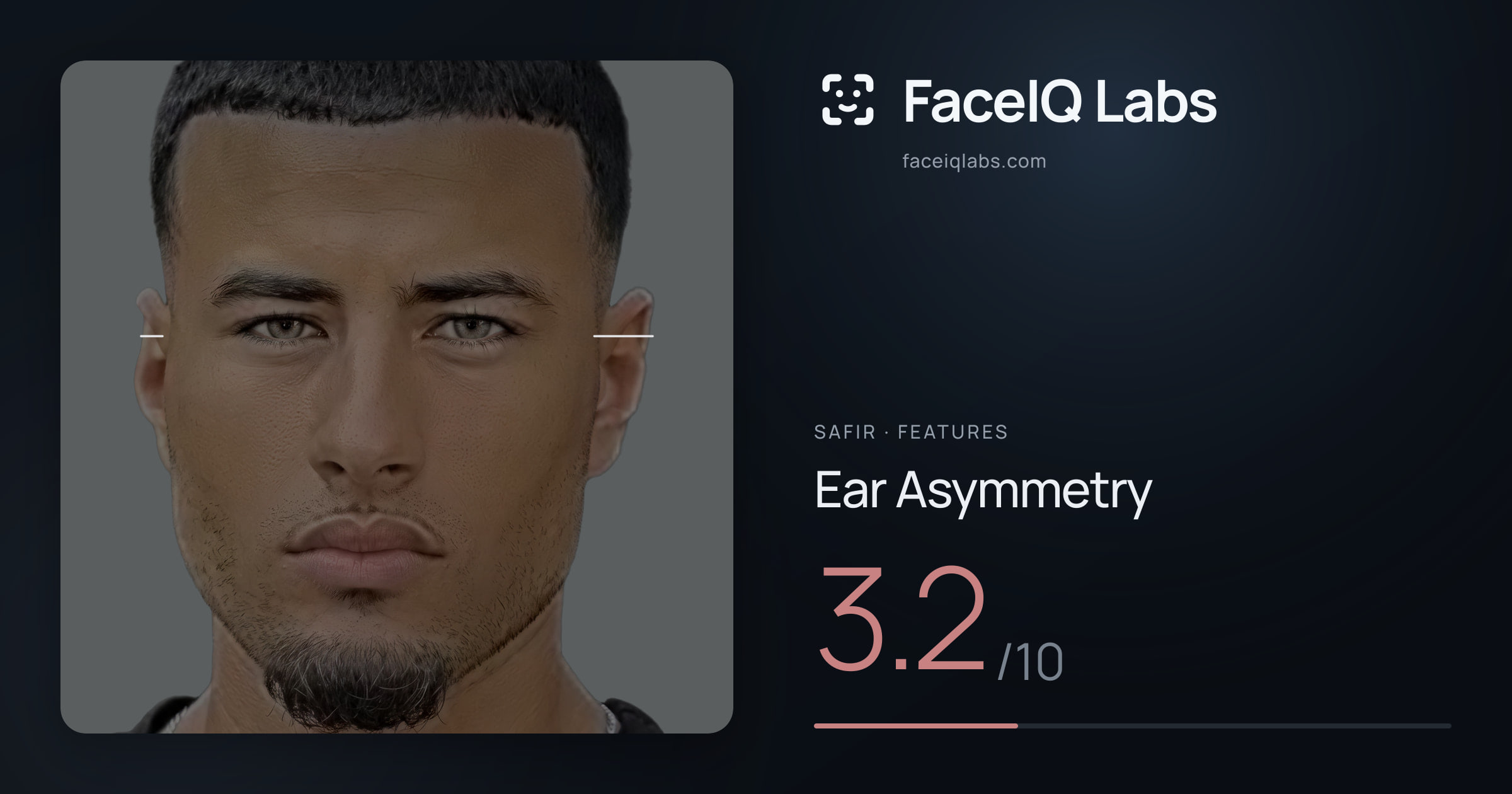 Safir Ear Asymmetry: 3.3/10, drawn on the photo