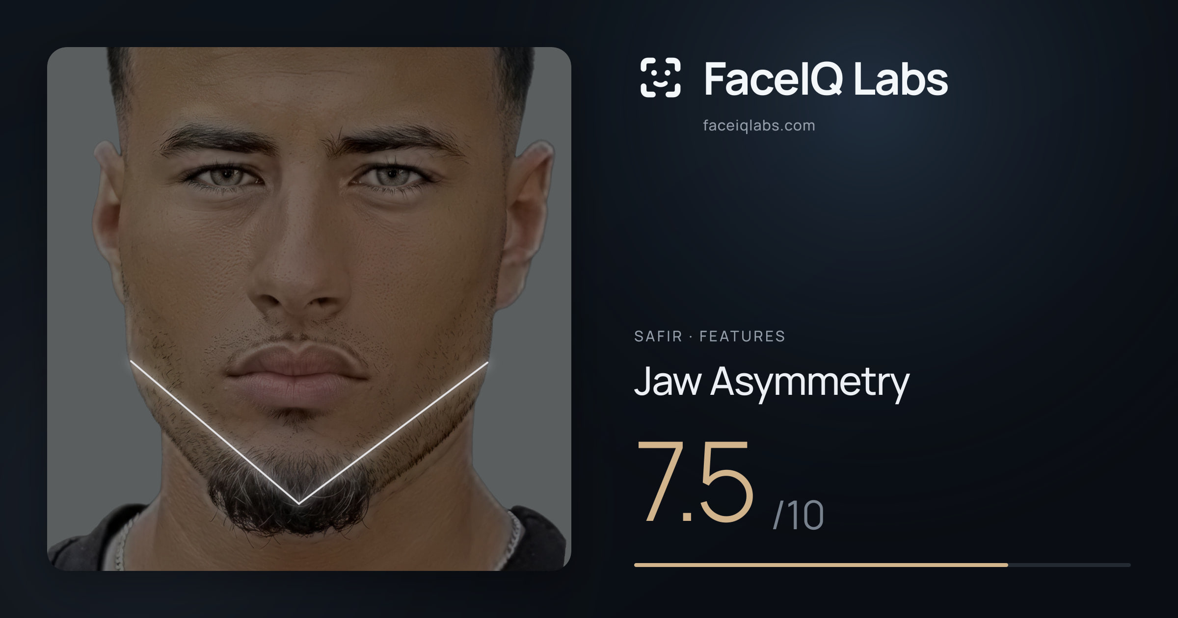 Safir Jaw Asymmetry: 7.5/10, drawn on the photo