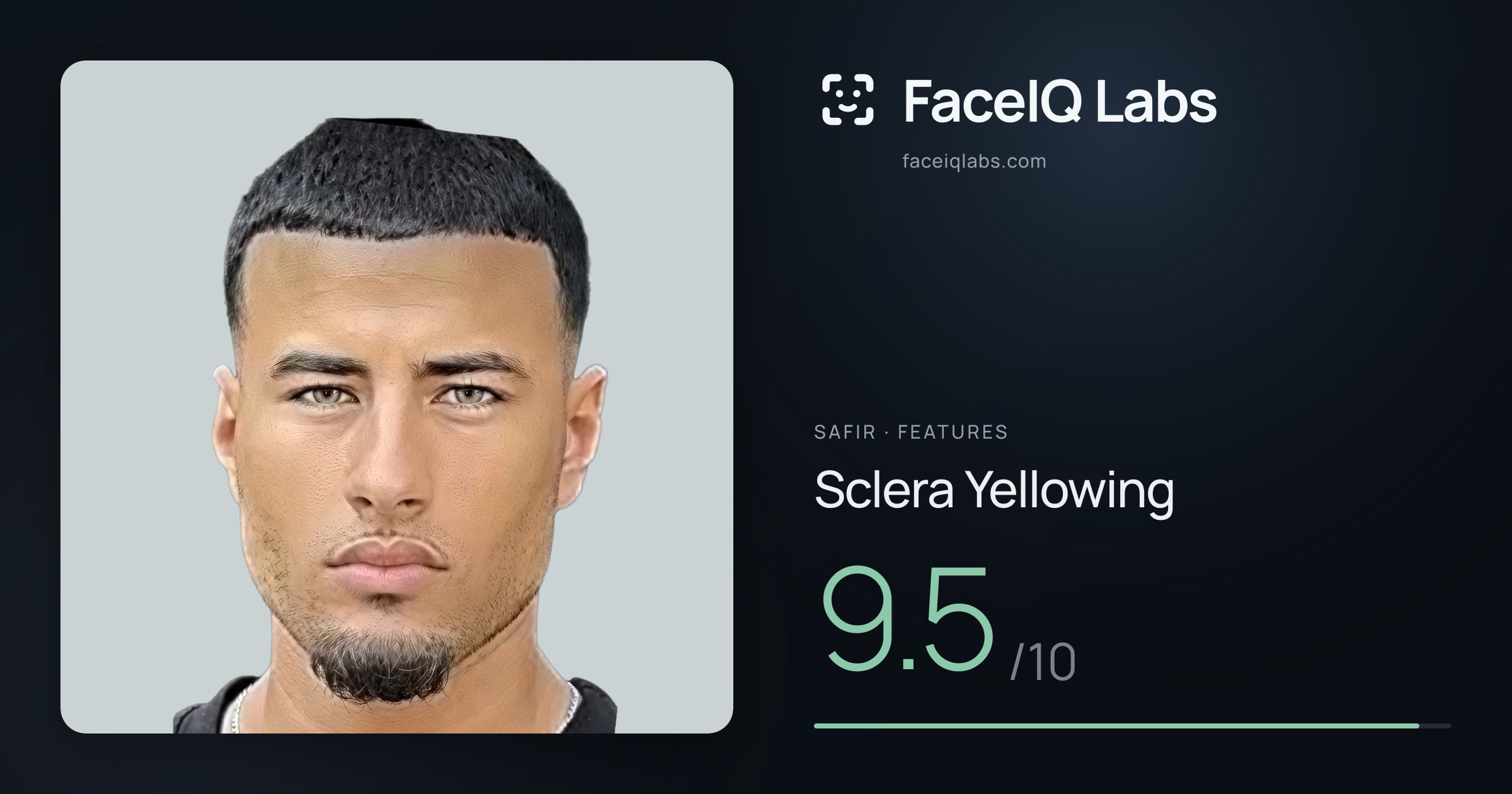 Safir Sclera Yellowing: 9.5/10, drawn on the photo