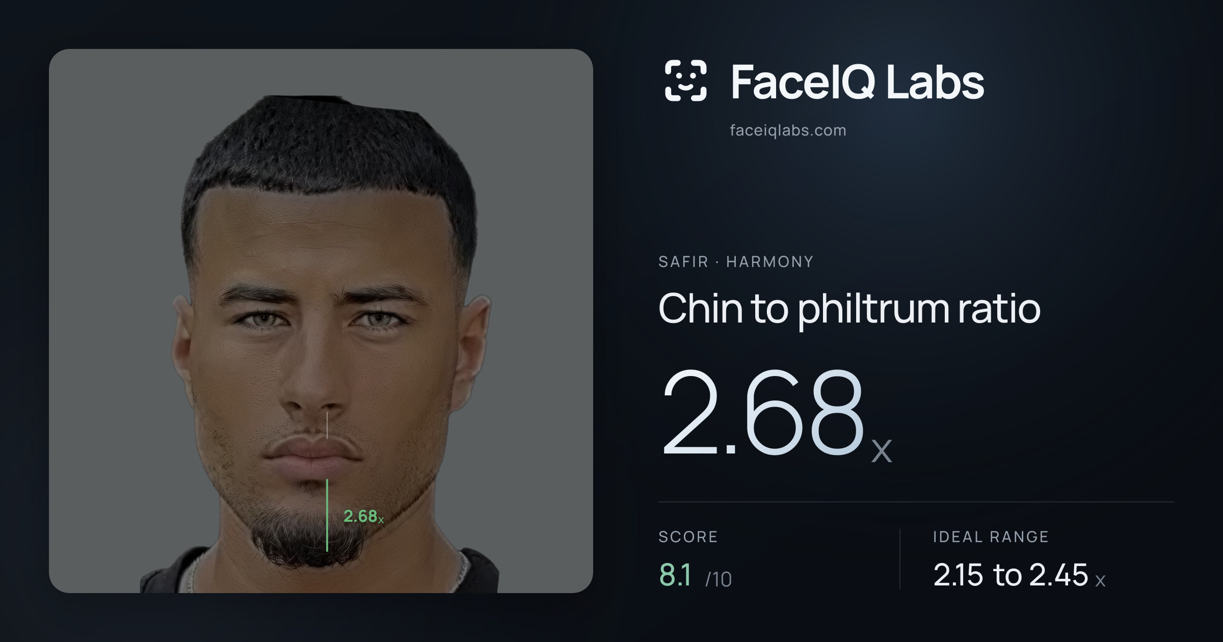 Safir Chin to philtrum ratio: 2.51x, drawn on the photo