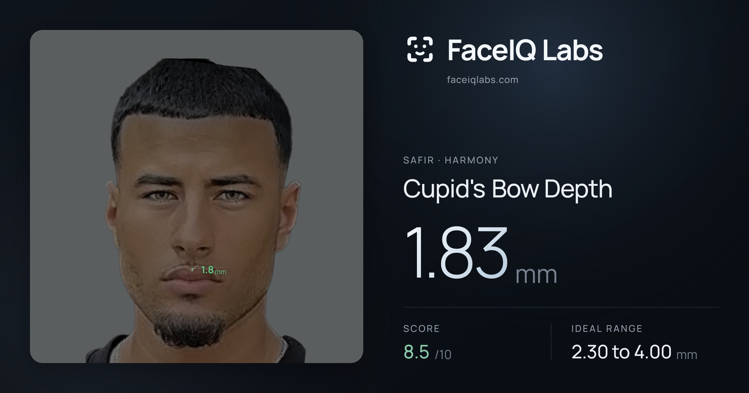 Safir Cupid's Bow Depth: 1.85mm, drawn on the photo