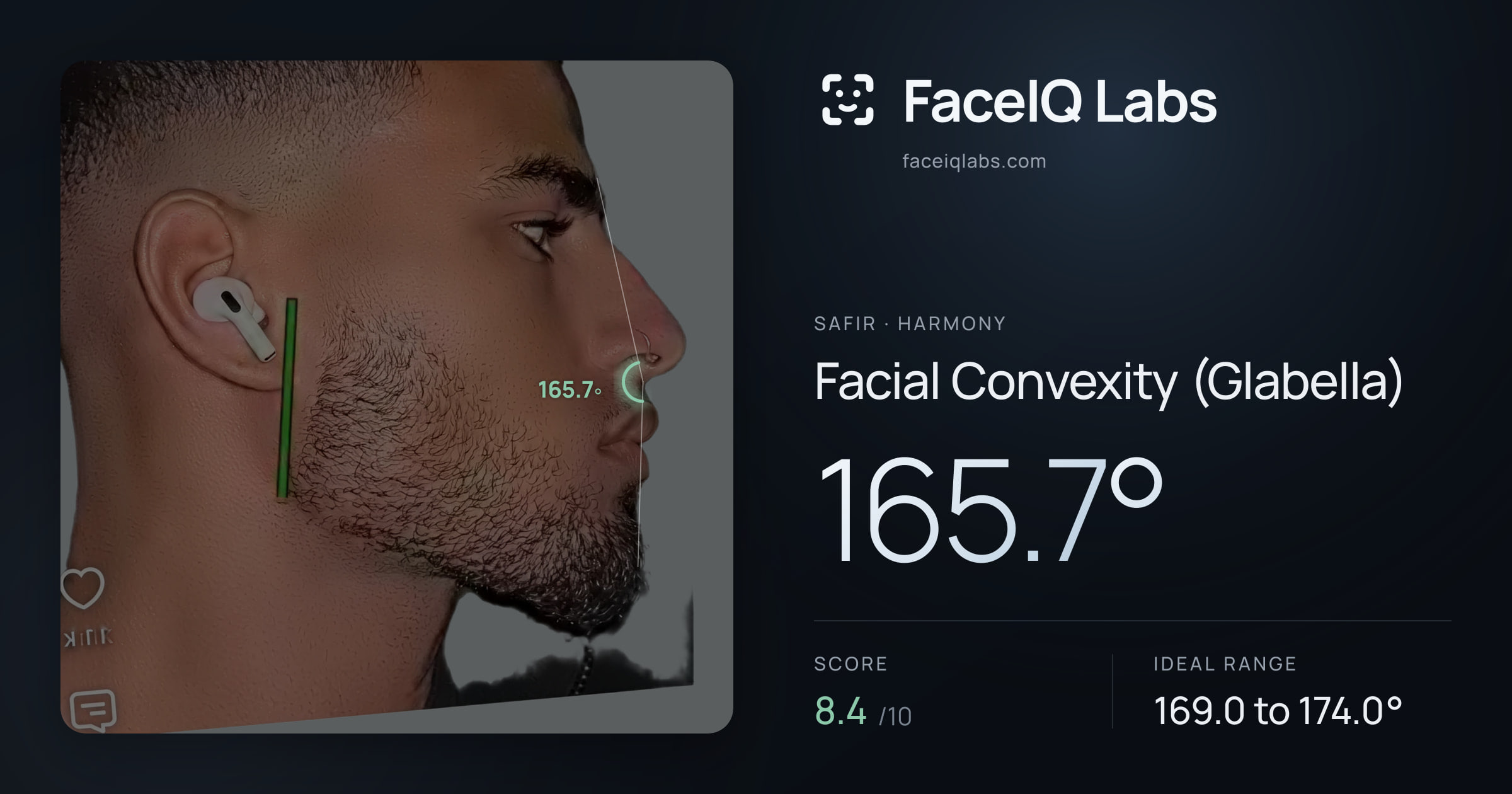 Safir Facial Convexity (Glabella): 165.3°, drawn on the photo