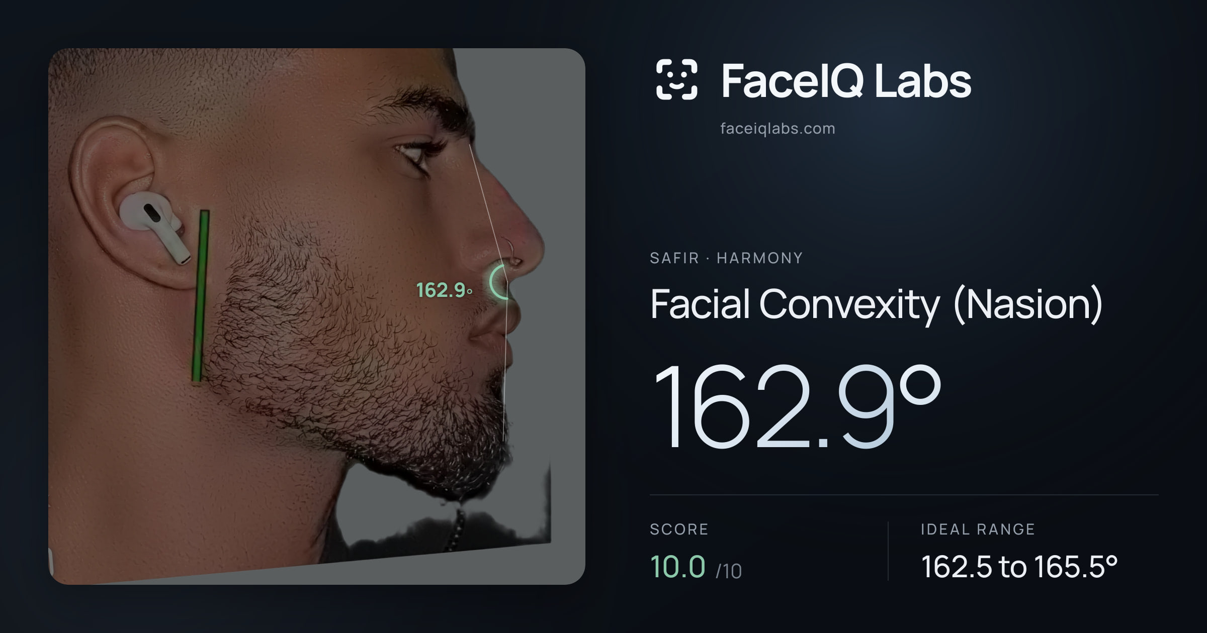 Safir Facial Convexity (Nasion): 162.9°, drawn on the photo