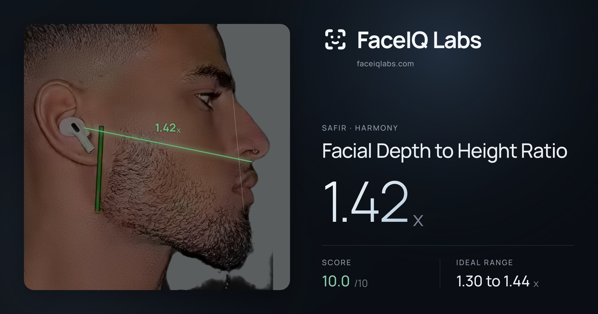 Safir Facial Depth to Height Ratio: 1.42x, drawn on the photo