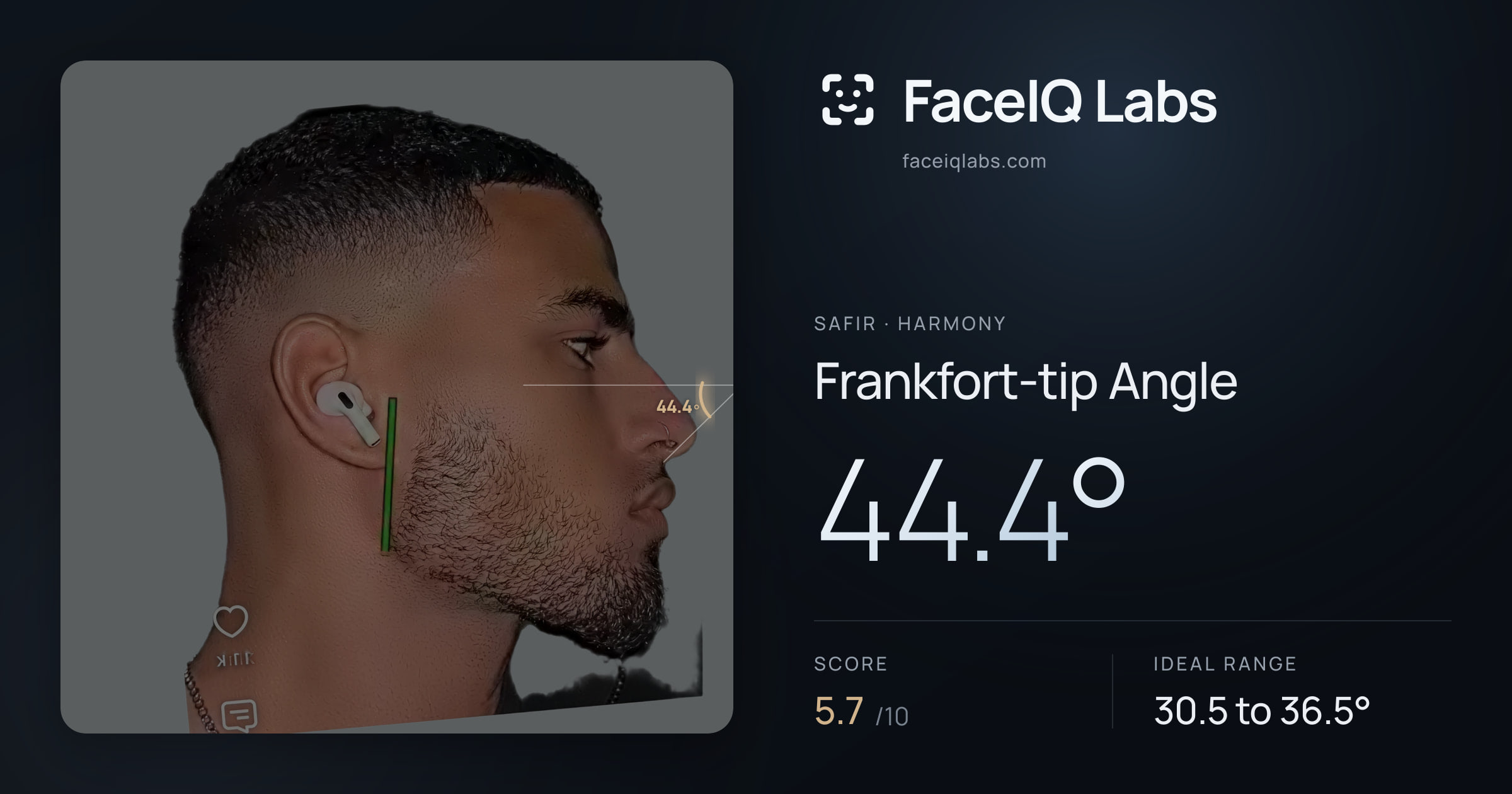 Safir Frankfort-tip Angle: 44.4°, drawn on the photo