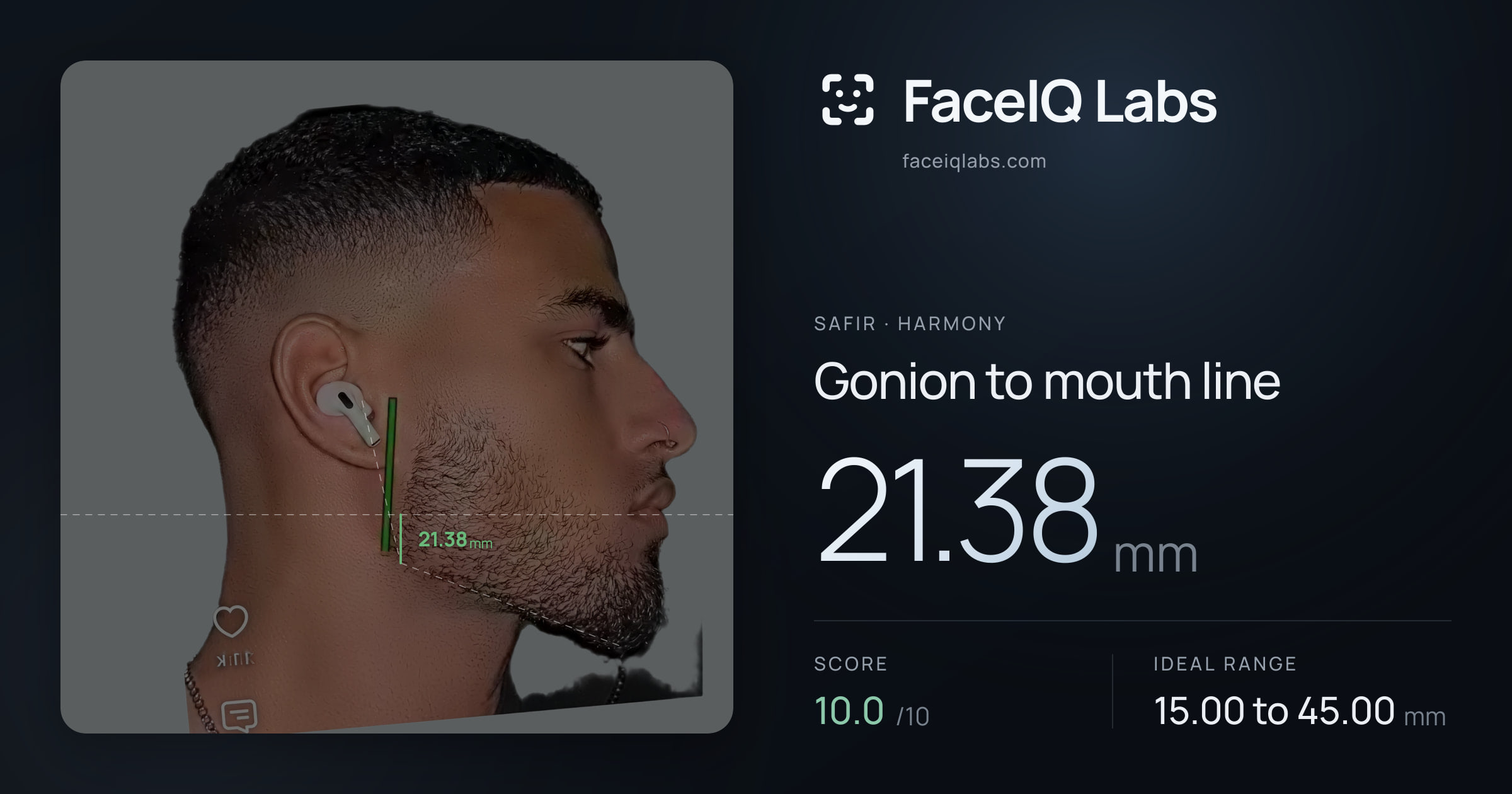 Safir Gonion to mouth line: 21.80mm, drawn on the photo