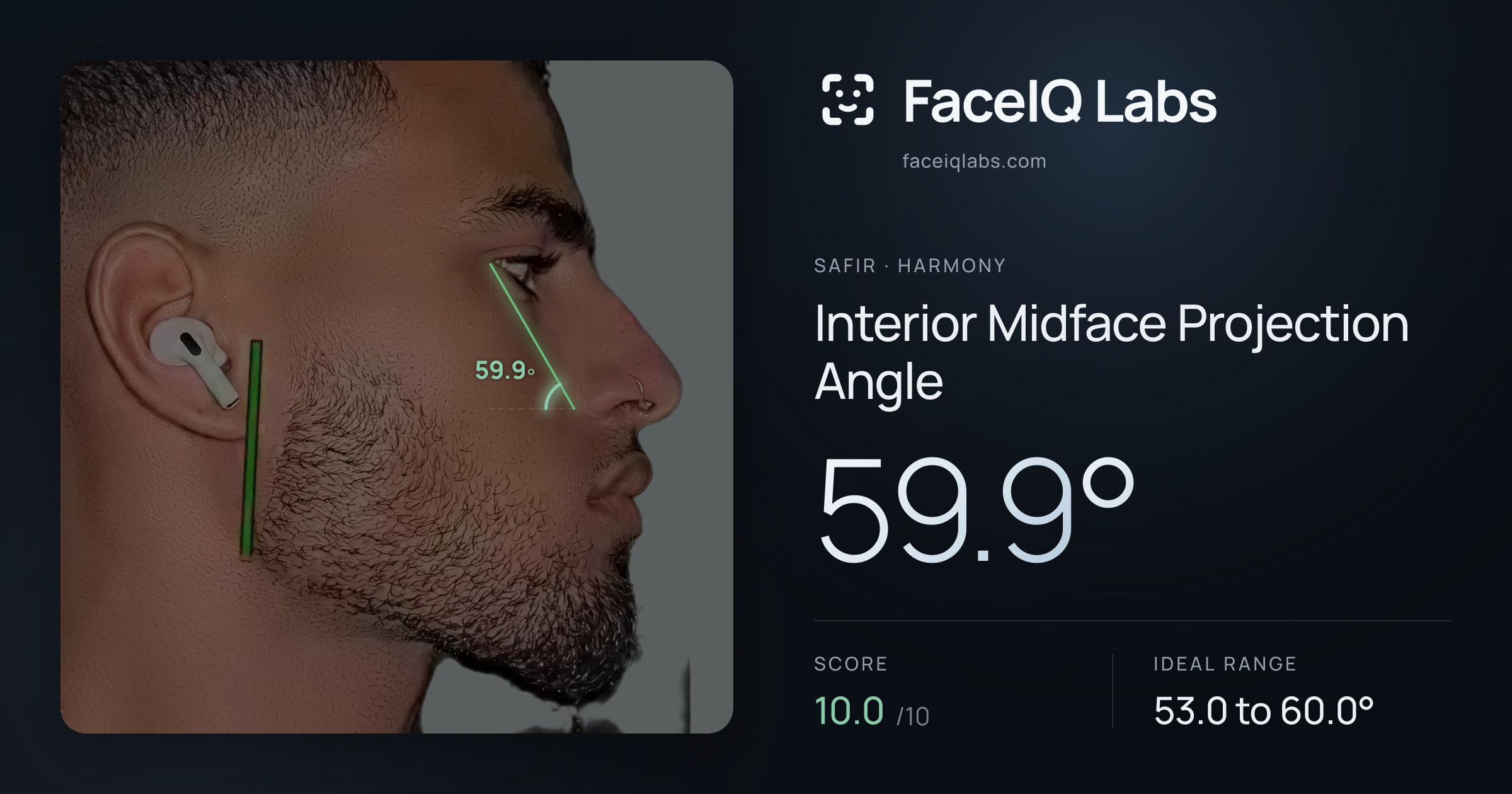 Safir Interior Midface Projection Angle: 59.9°, drawn on the photo