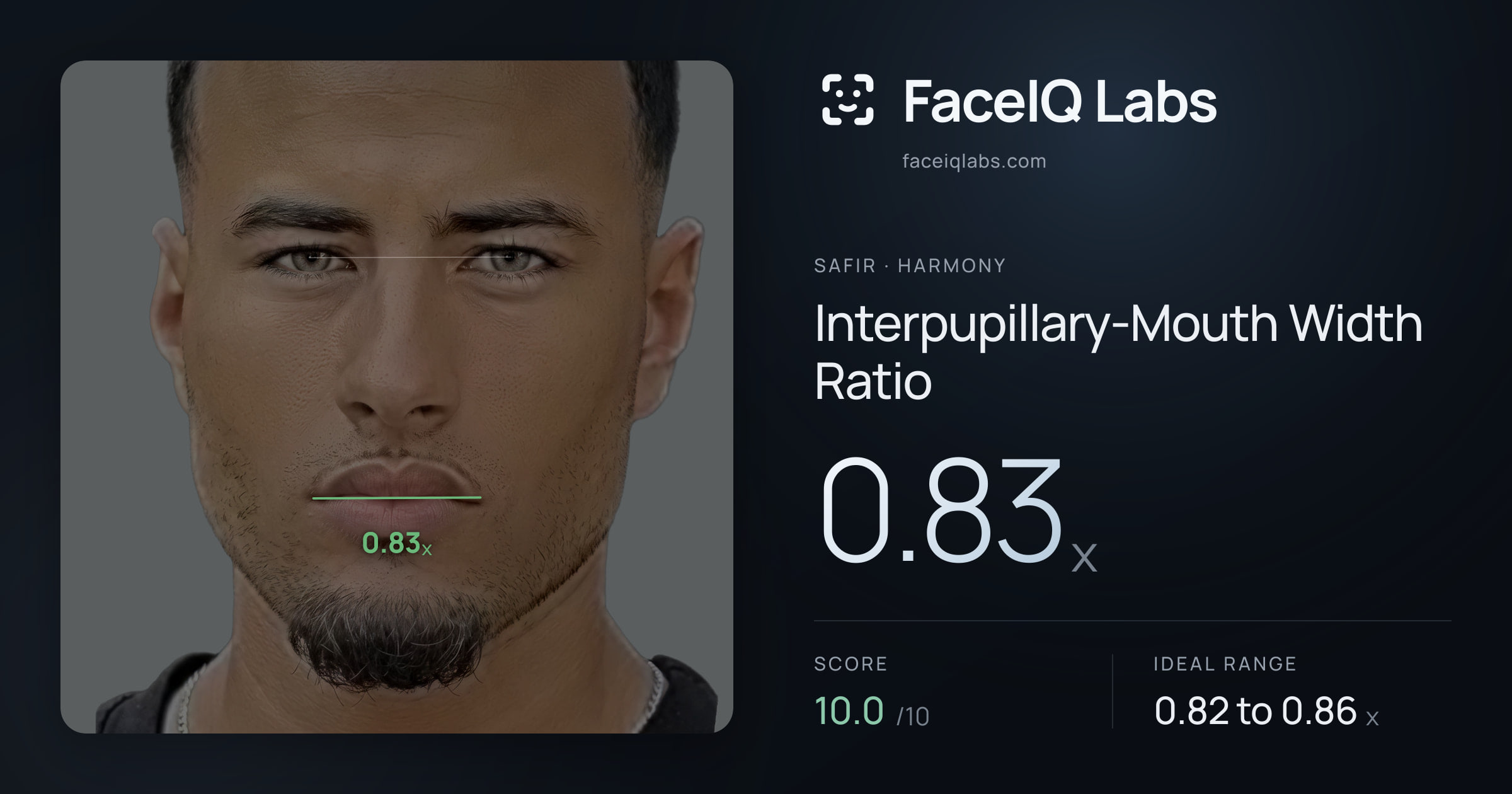 Safir Interpupillary-Mouth Width Ratio: 0.83x, drawn on the photo