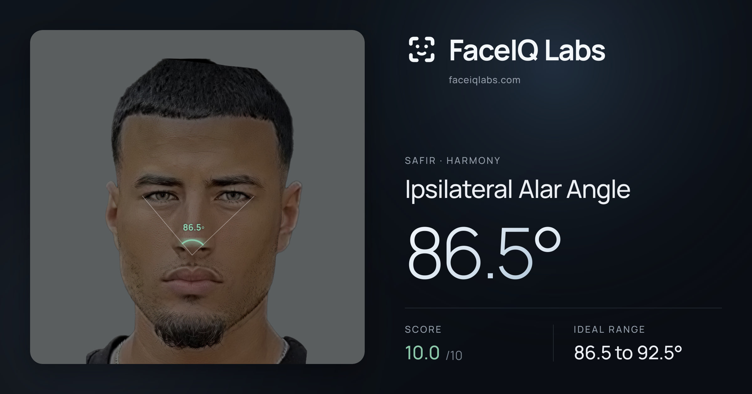 Safir Ipsilateral Alar Angle: 85.8°, drawn on the photo