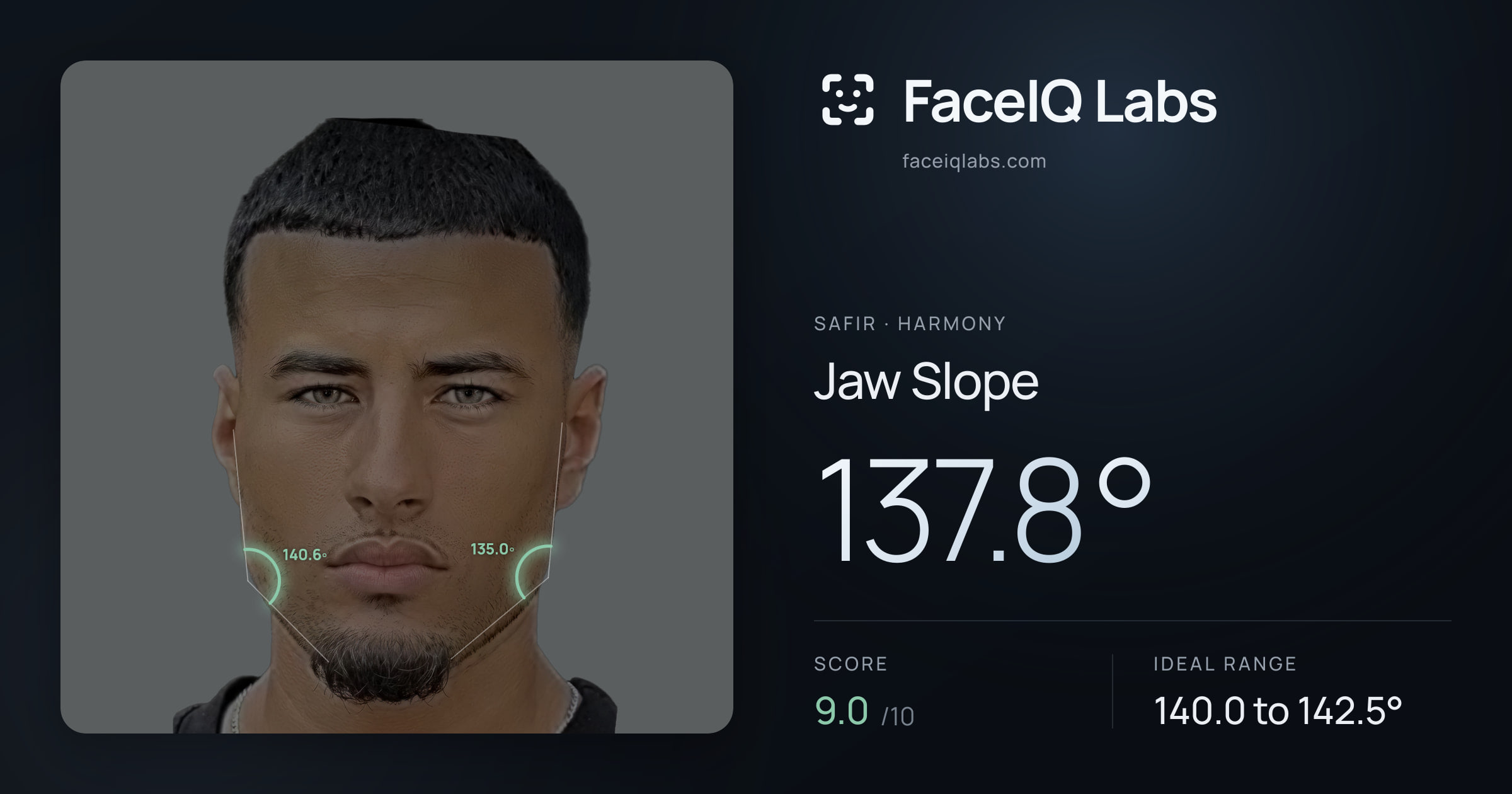 Safir Jaw Slope: 137.8°, drawn on the photo