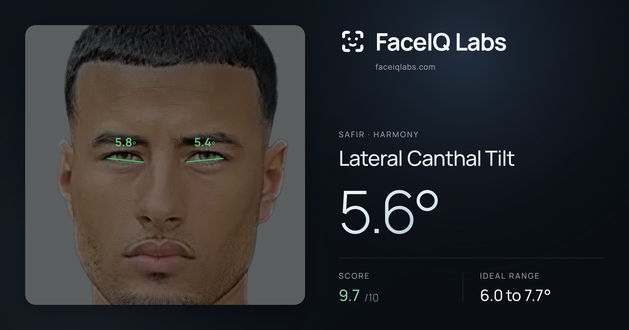 Safir Lateral Canthal Tilt: 5.6°, drawn on the photo