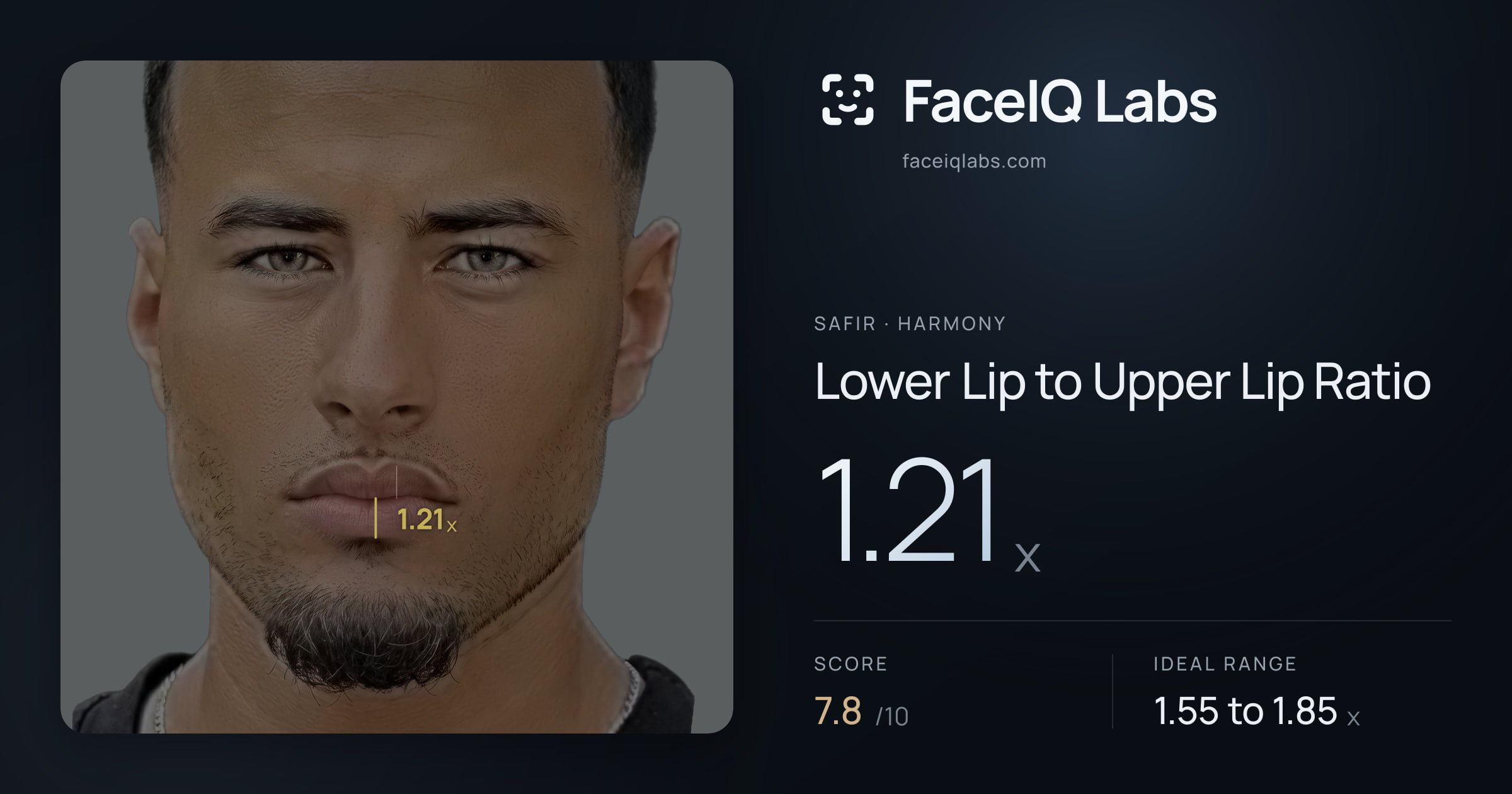 Safir Lower Lip to Upper Lip Ratio: 1.21x, drawn on the photo