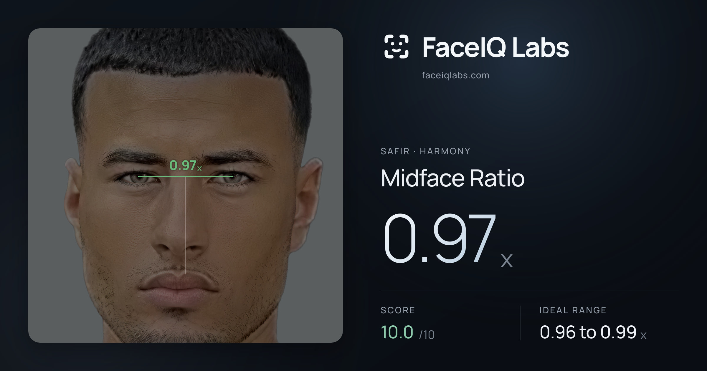 Safir Midface Ratio: 0.97x, drawn on the photo
