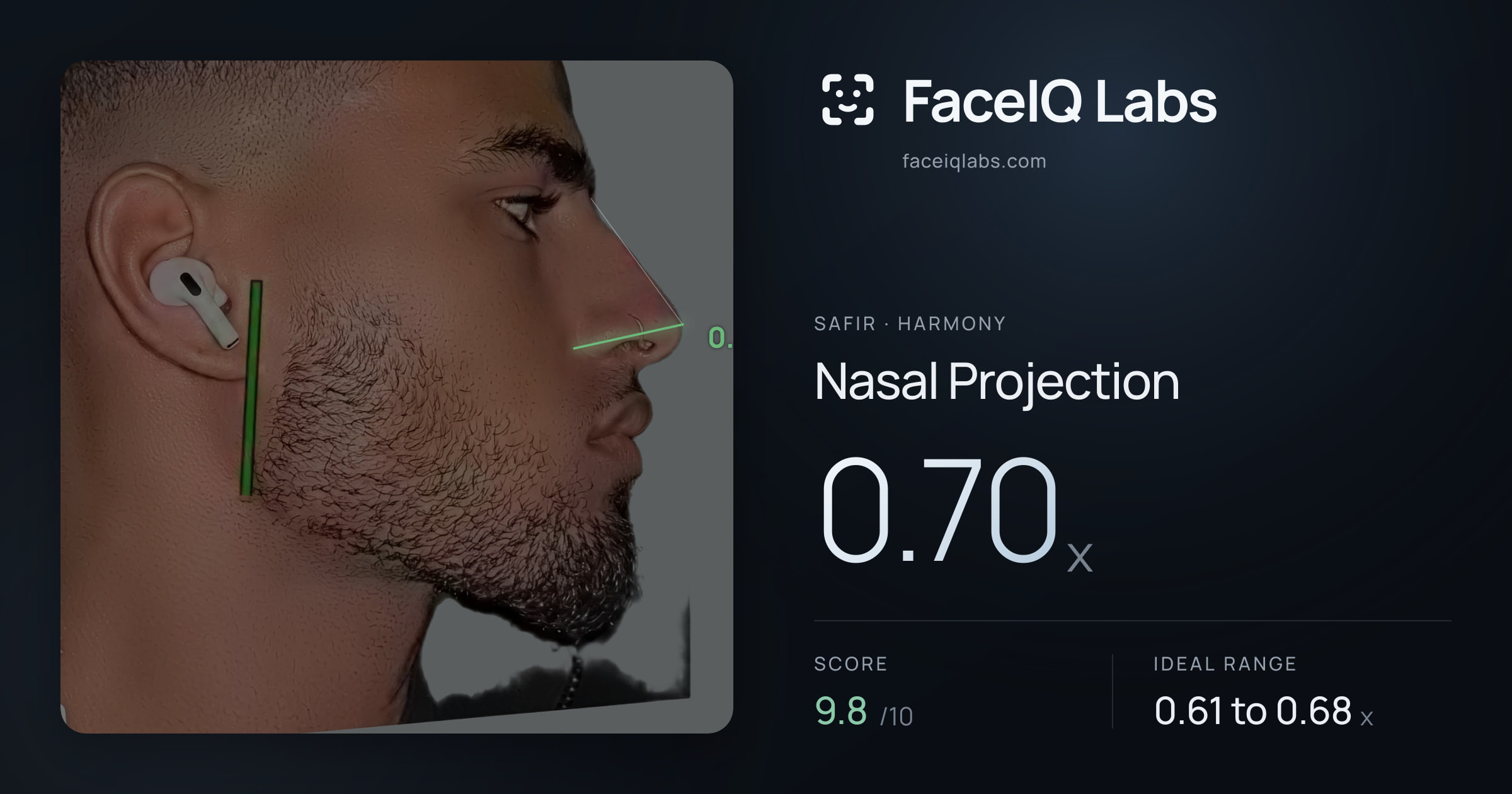 Safir Nasal Projection: 0.70x, drawn on the photo