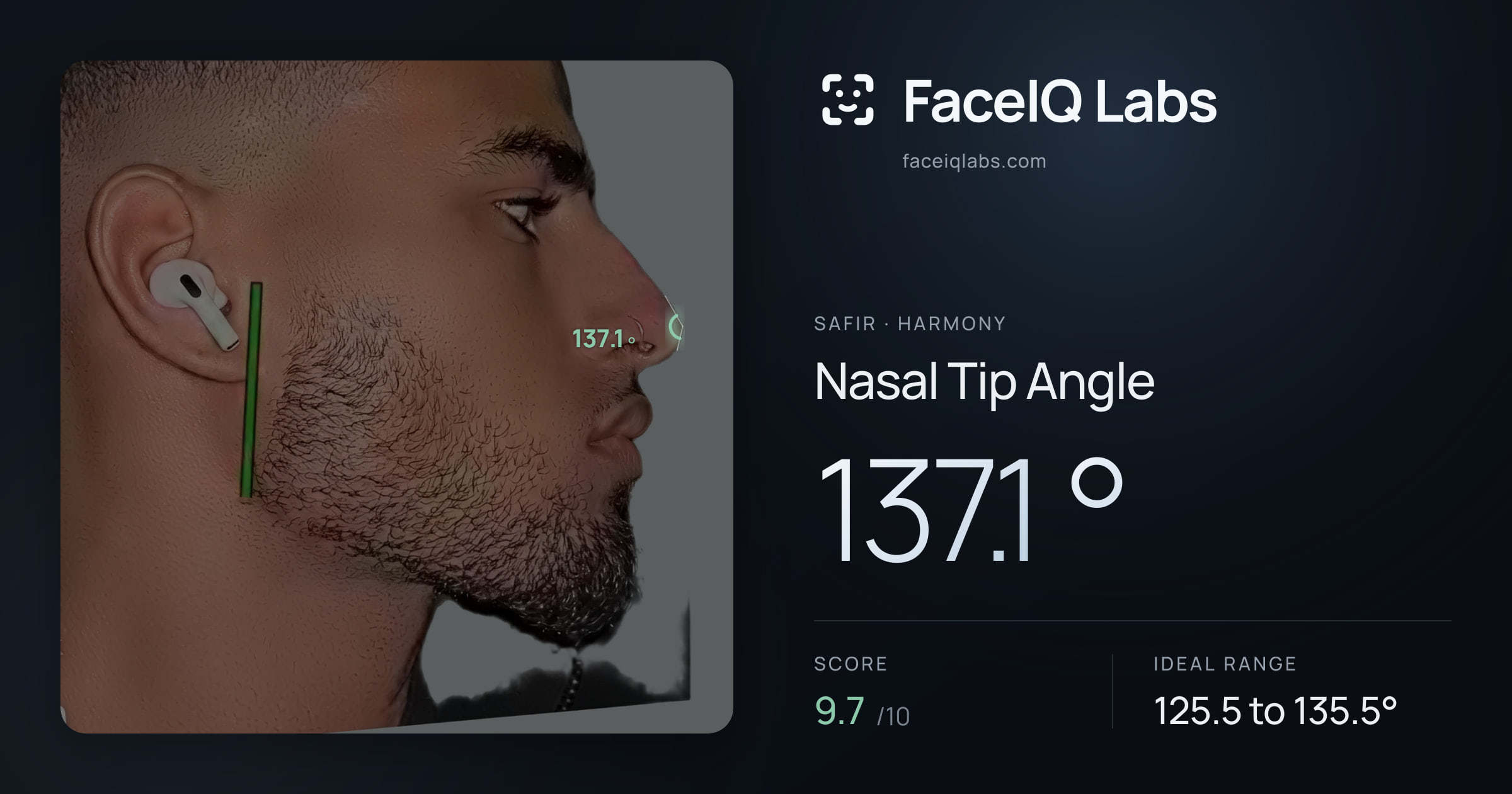 Safir Nasal Tip Angle: 137.1°, drawn on the photo