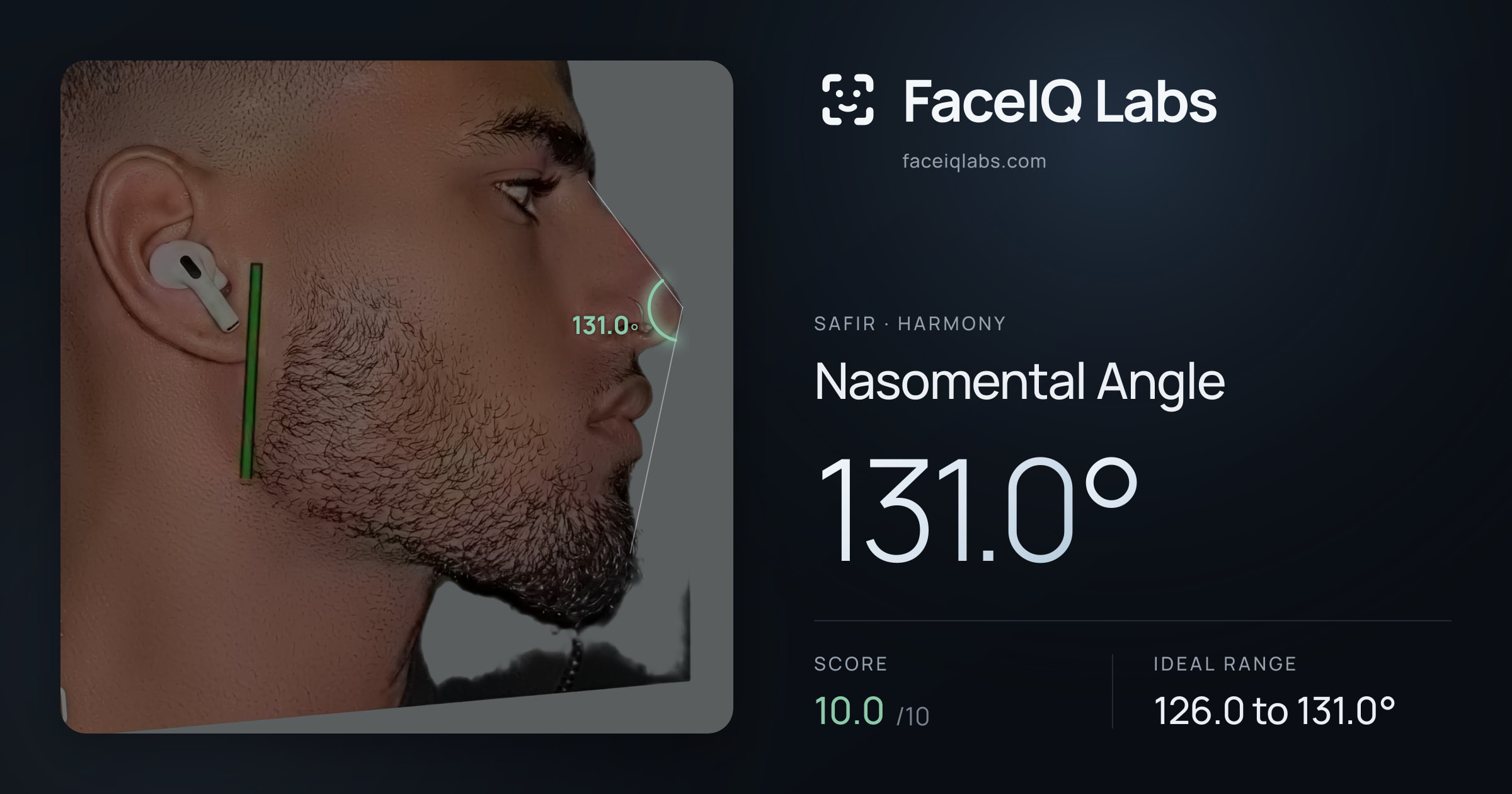 Safir Nasomental Angle: 131.0°, drawn on the photo