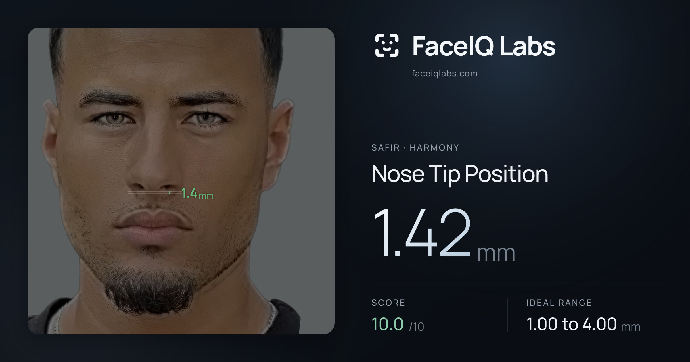 Safir Nose Tip Position: 1.42mm, drawn on the photo