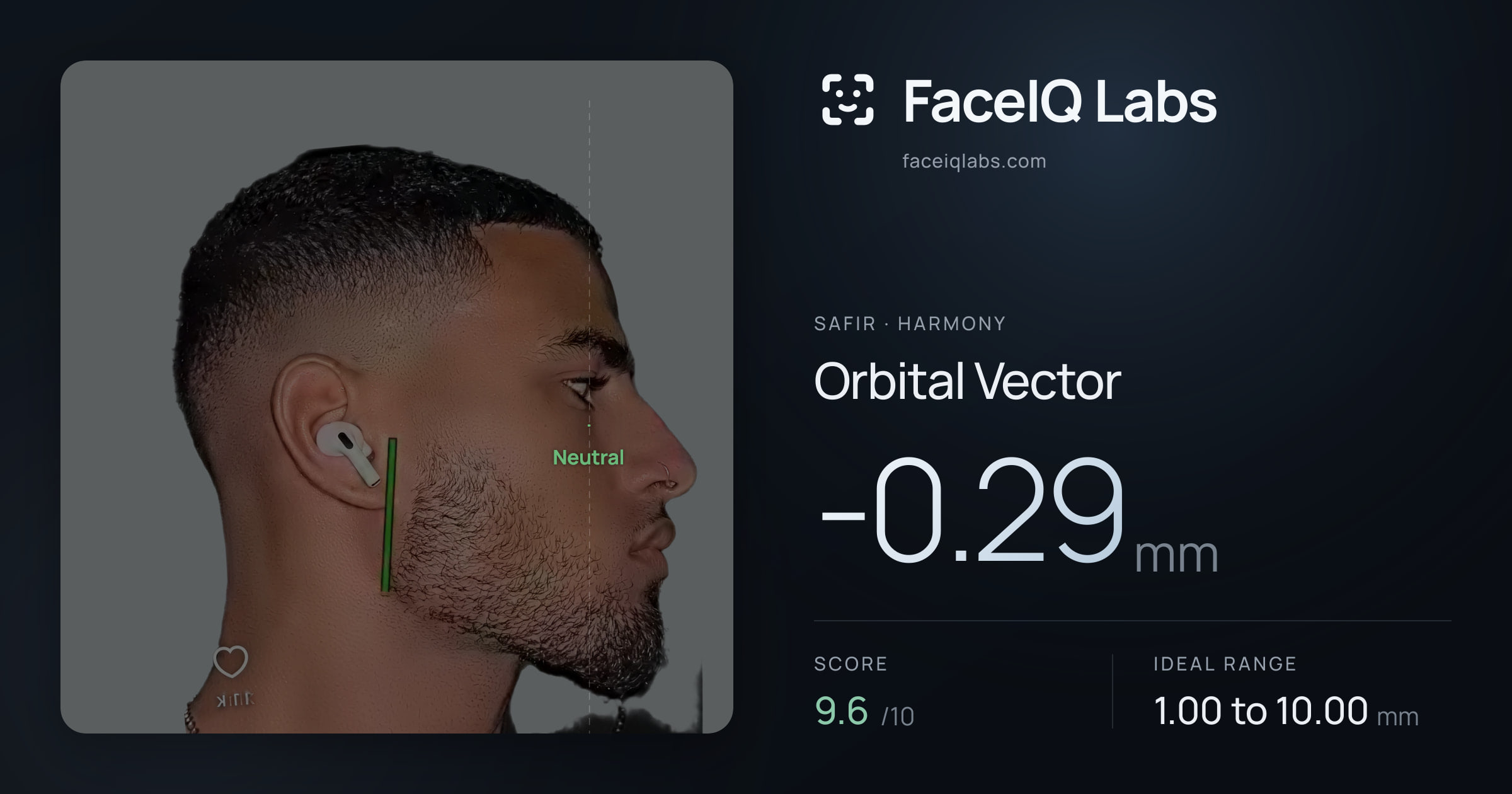 Safir Orbital Vector: -0.29mm, drawn on the photo