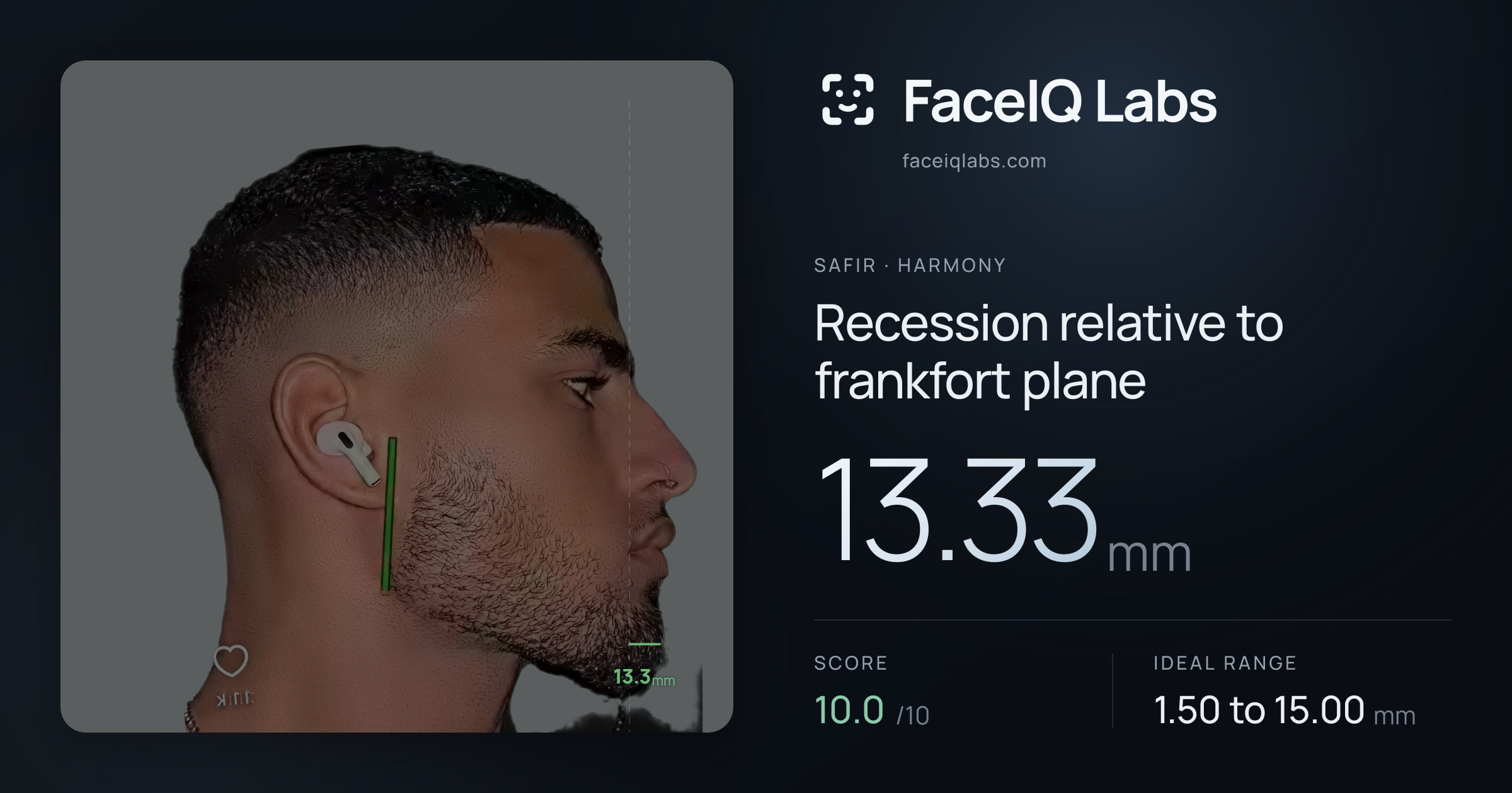 Safir Recession relative to frankfort plane: 13.42mm, drawn on the photo