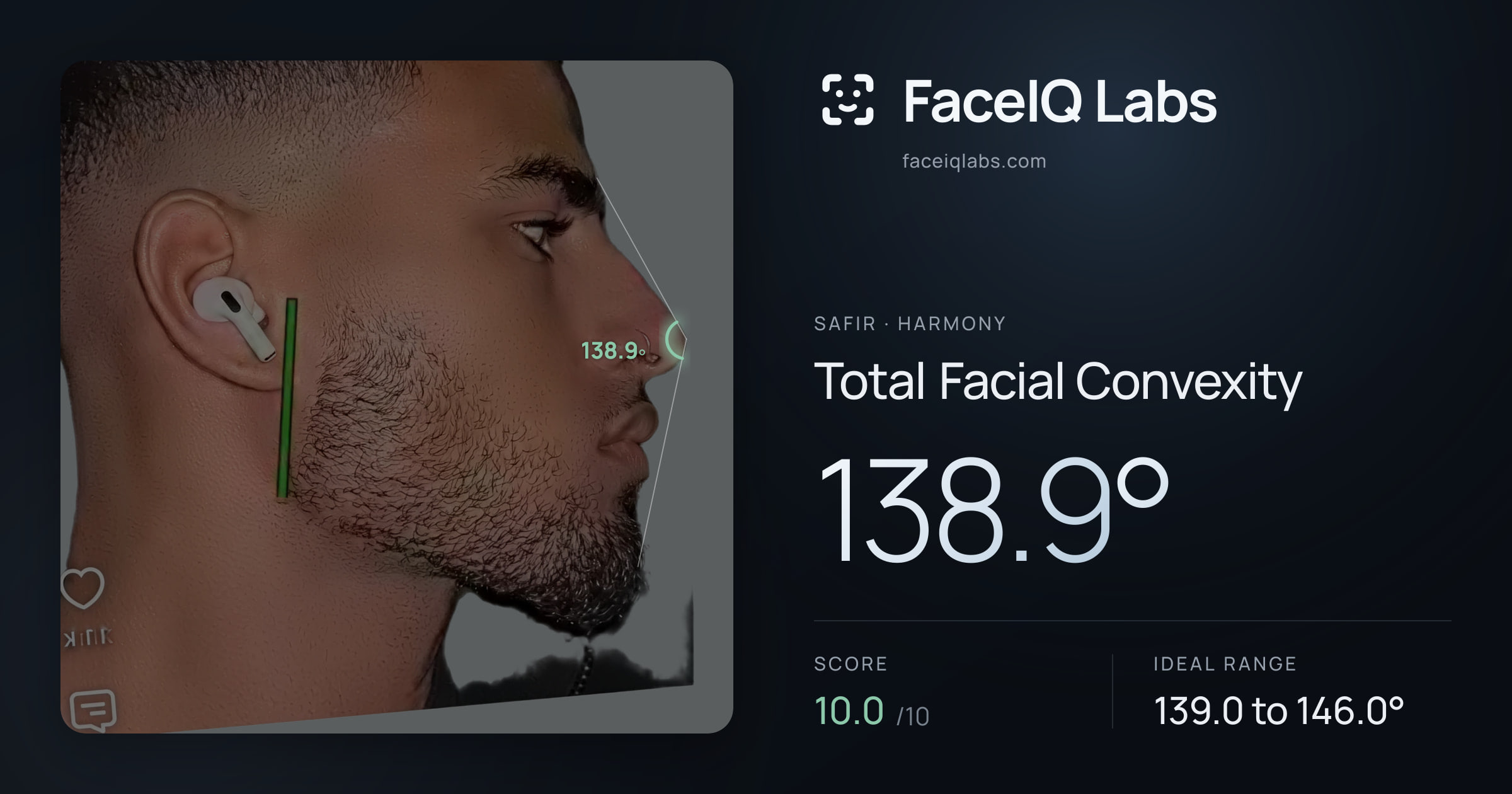 Safir Total Facial Convexity: 137.7°, drawn on the photo