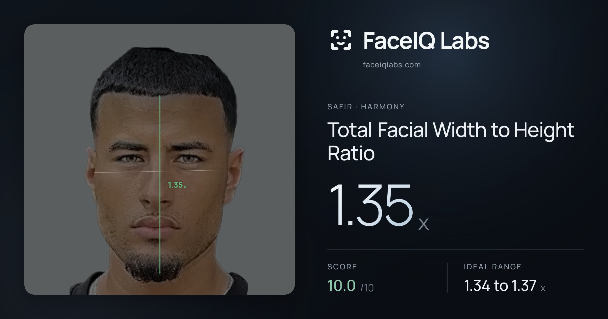 Safir Total Facial Width to Height Ratio: 1.34x, drawn on the photo