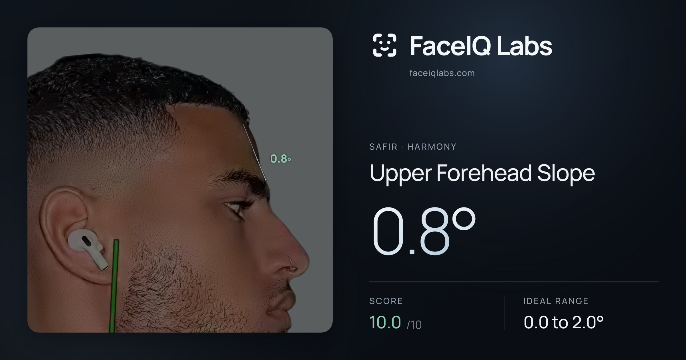 Safir Upper Forehead Slope: 0.1°, drawn on the photo