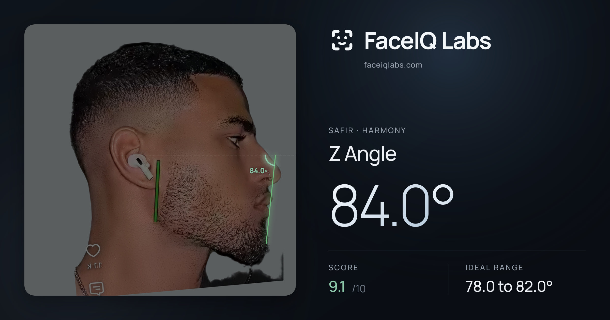 Safir Z Angle: 84.0°, drawn on the photo