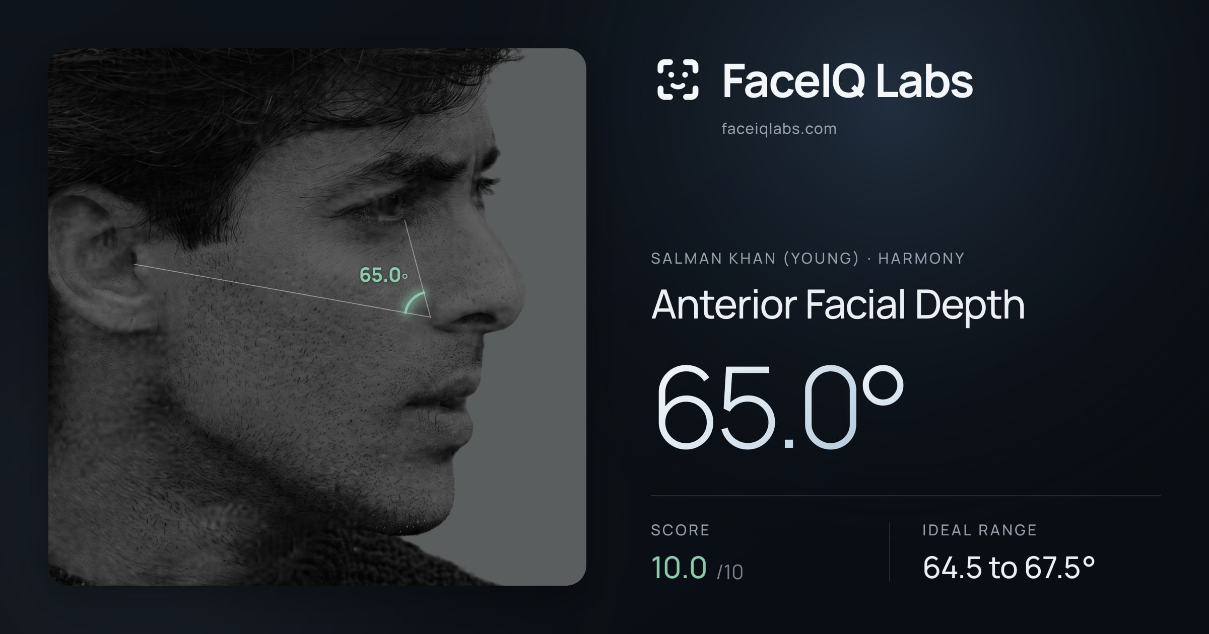 Salman Khan (Young) Anterior Facial Depth: 65.0°, drawn on the photo