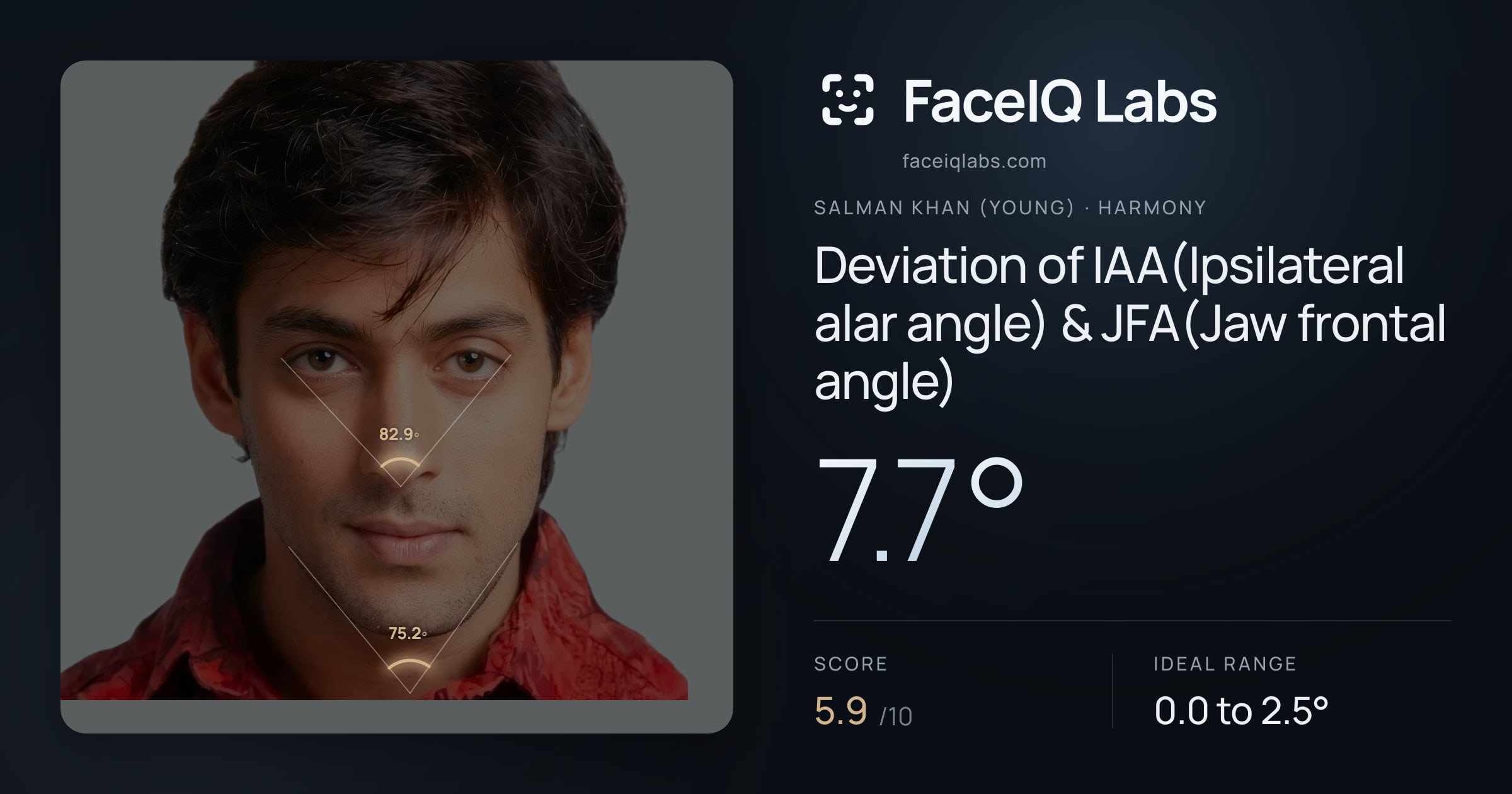 Salman Khan (Young) Deviation of IAA(Ipsilateral alar angle) & JFA(Jaw frontal angle): 7.7°, drawn on the photo
