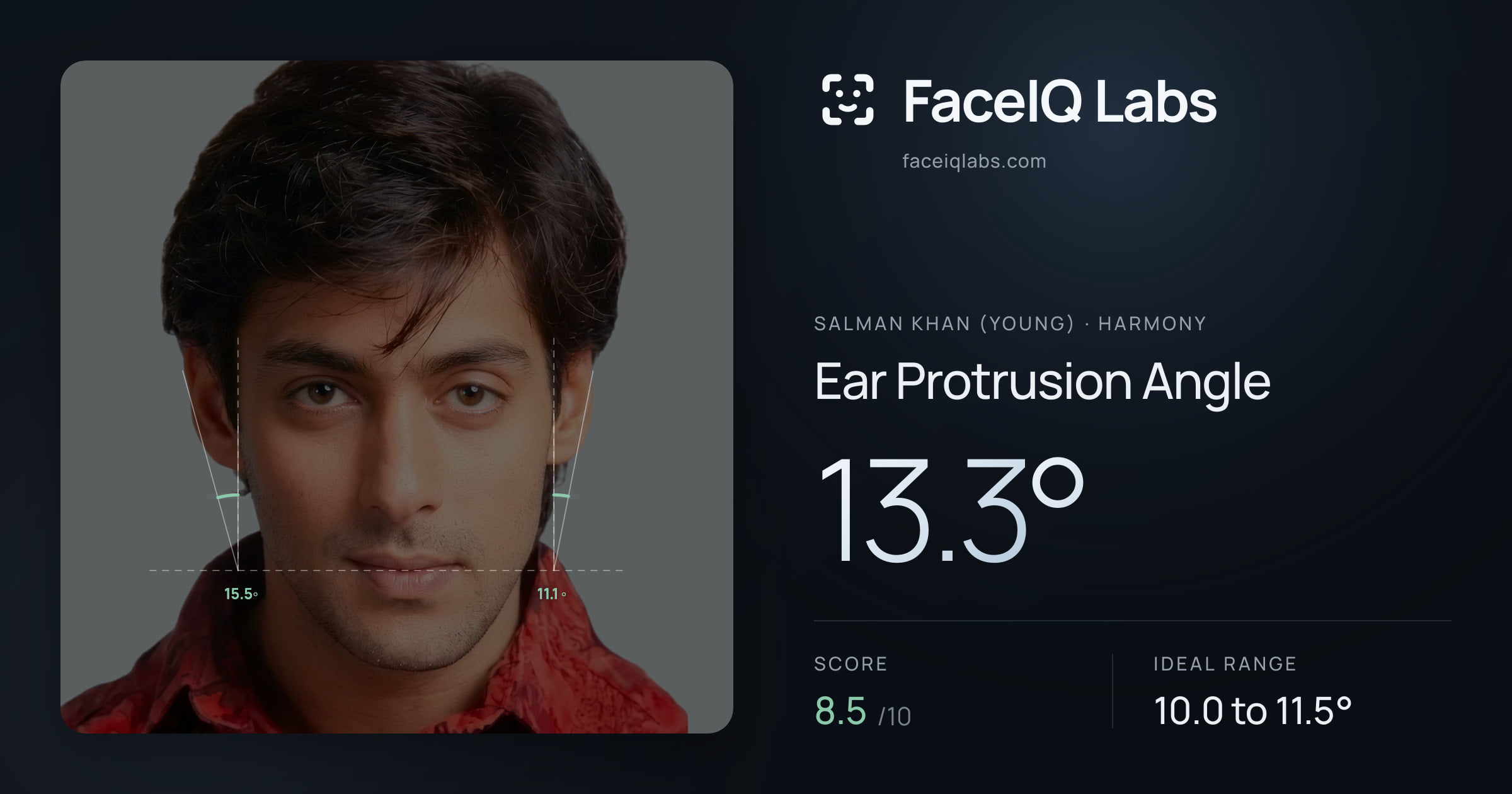 Salman Khan (Young) Ear Protrusion Angle: 13.3°, drawn on the photo