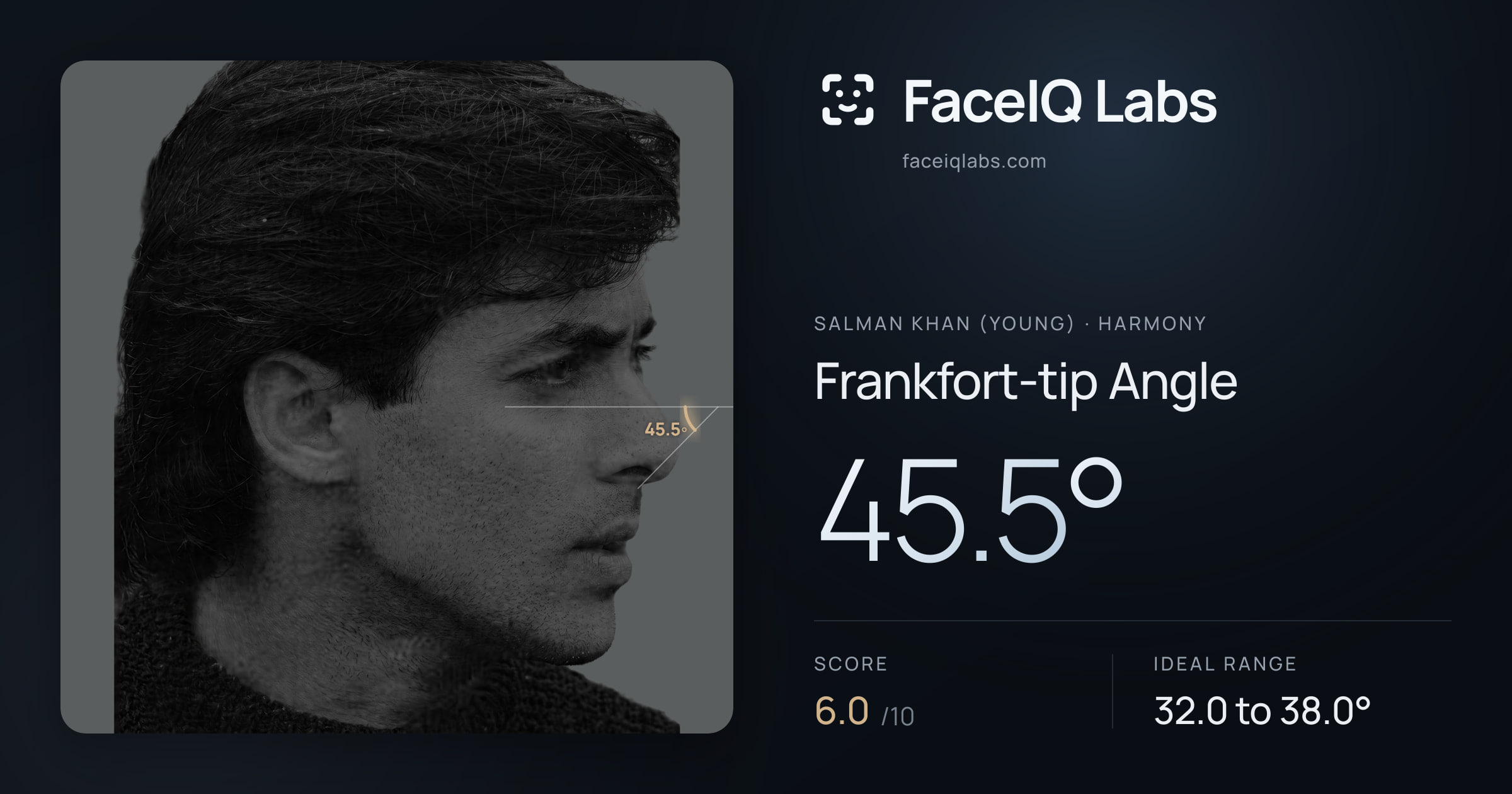 Salman Khan (Young) Frankfort-tip Angle: 45.5°, drawn on the photo