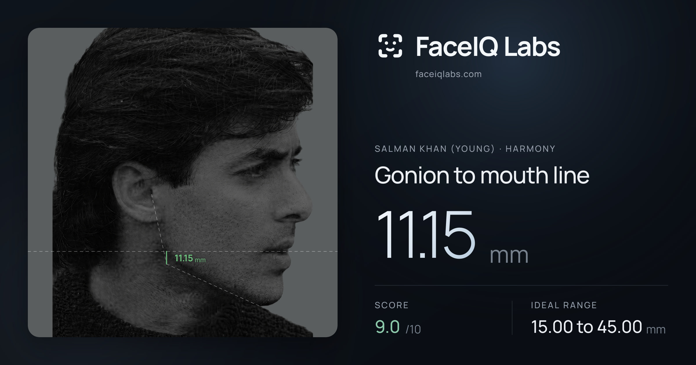 Salman Khan (Young) Gonion to mouth line: 11.15mm, drawn on the photo