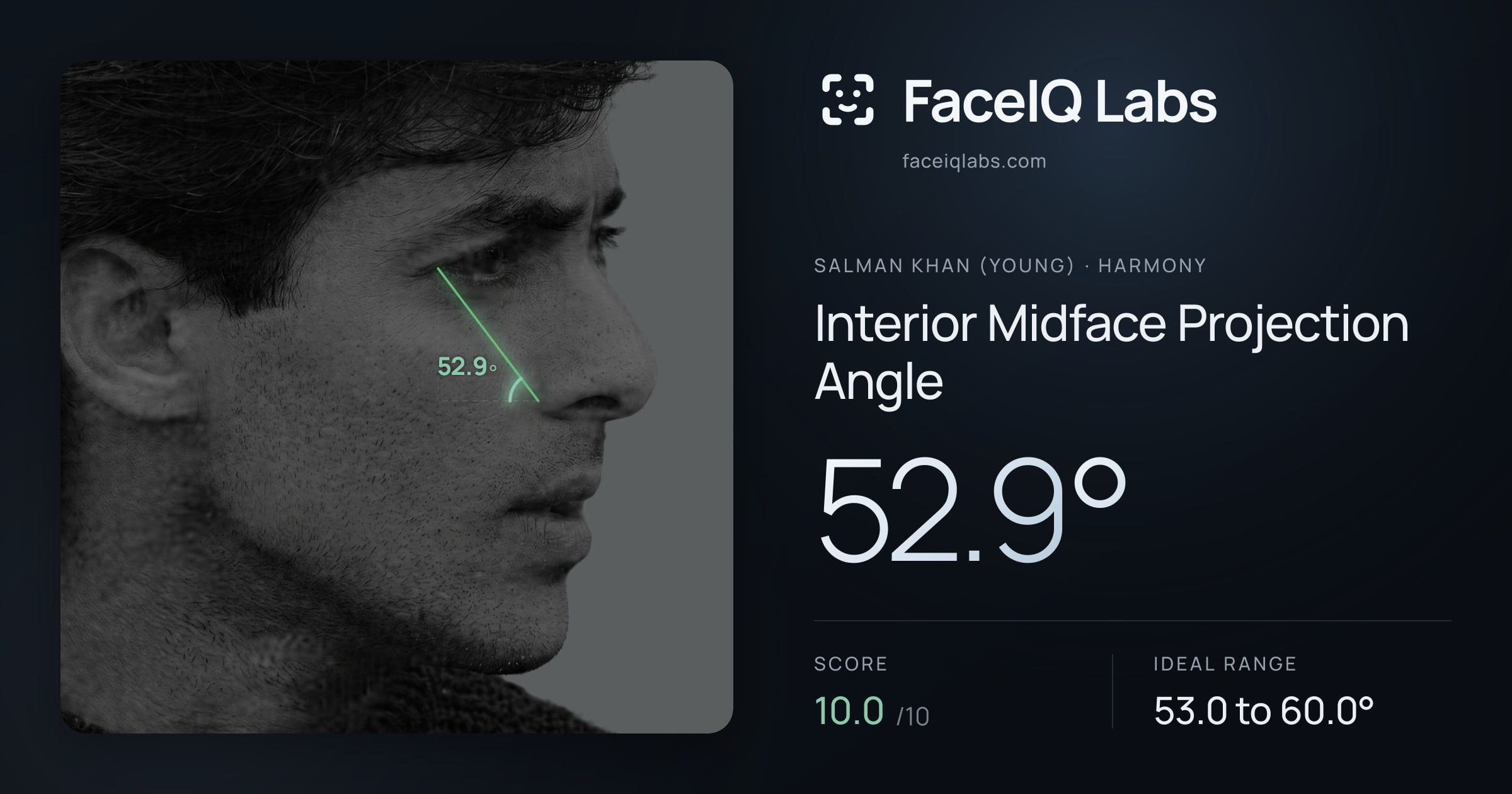 Salman Khan (Young) Interior Midface Projection Angle: 52.9°, drawn on the photo