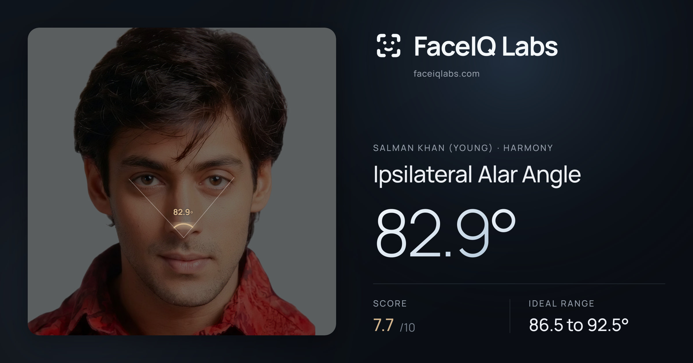 Salman Khan (Young) Ipsilateral Alar Angle: 82.9°, drawn on the photo