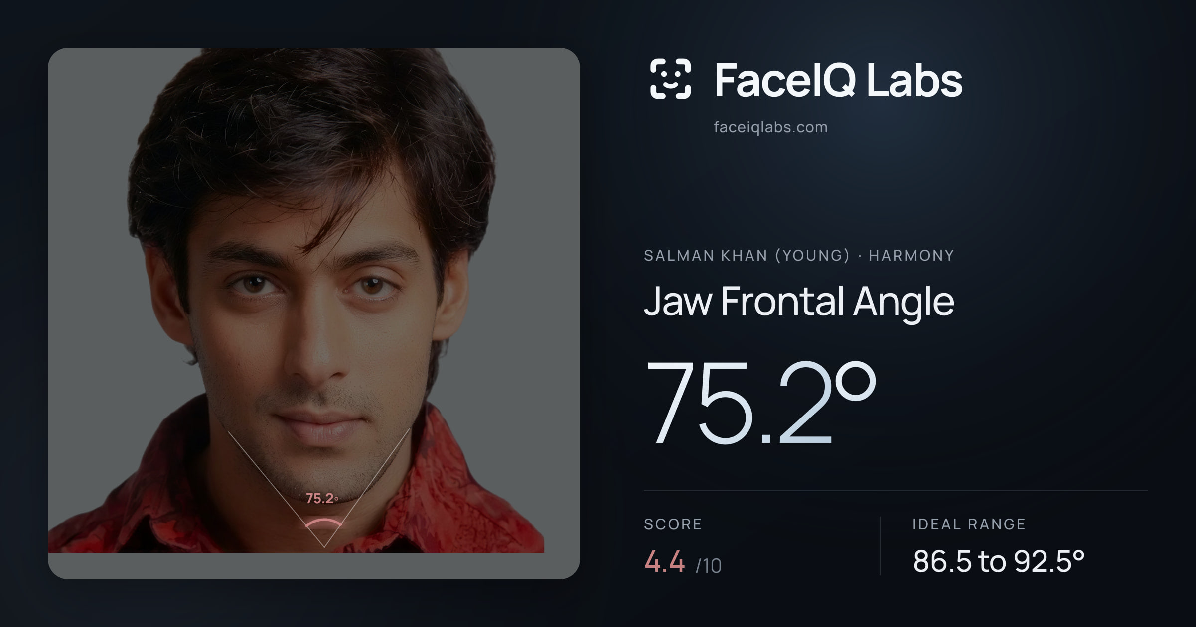Salman Khan (Young) Jaw Frontal Angle: 75.2°, drawn on the photo