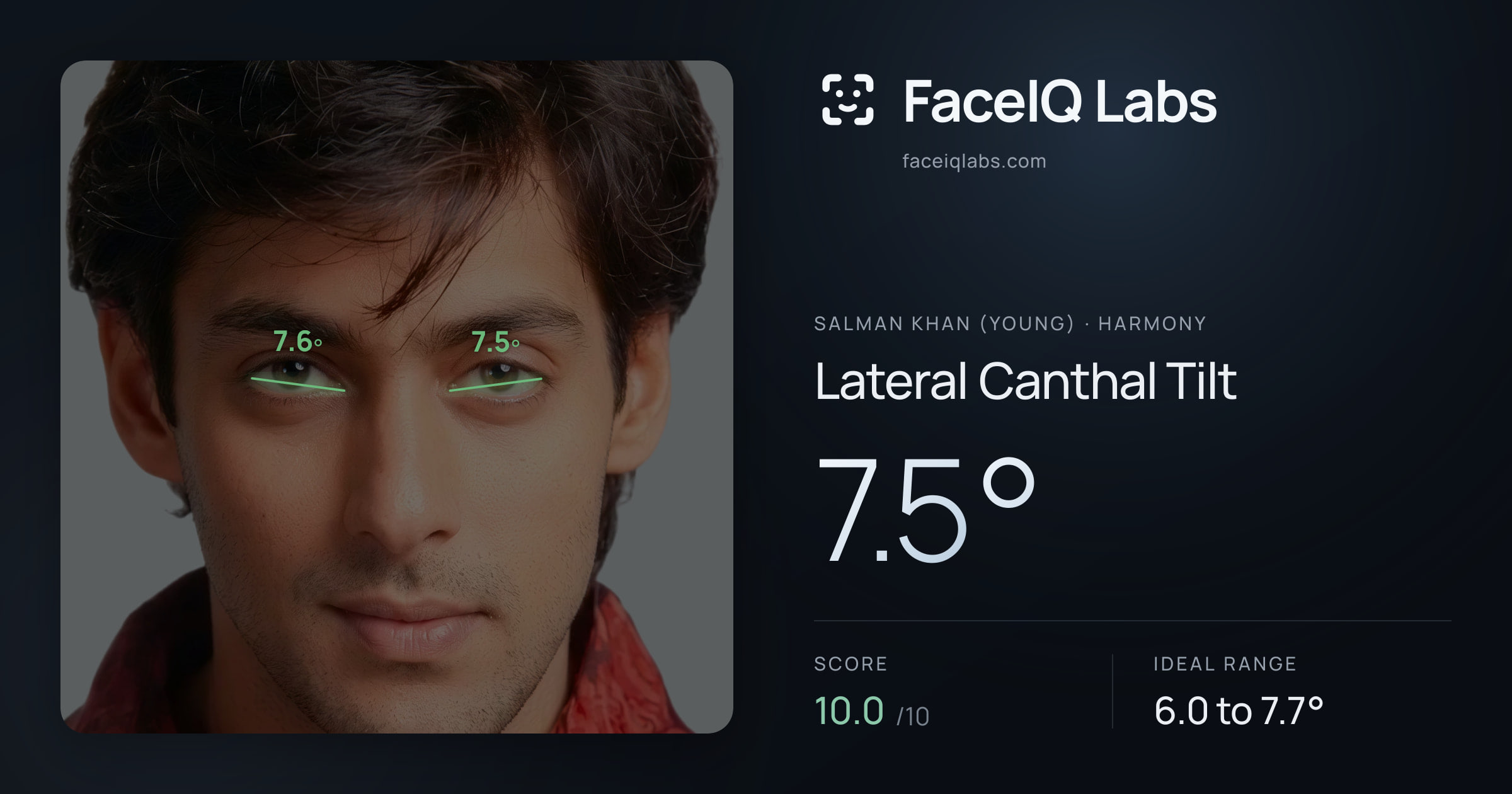 Salman Khan (Young) Lateral Canthal Tilt: 7.5°, drawn on the photo