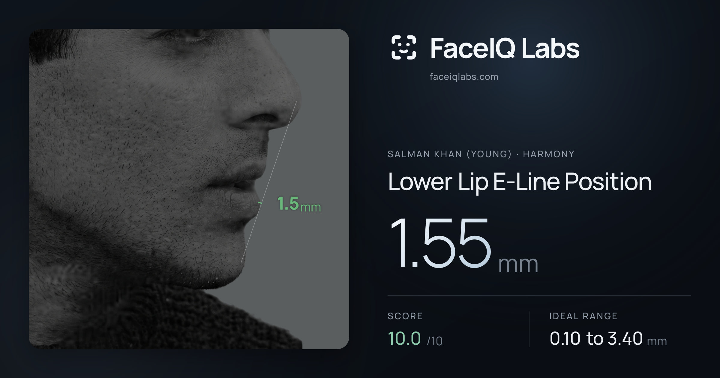 Salman Khan (Young) Lower Lip E-Line Position: 1.55mm, drawn on the photo