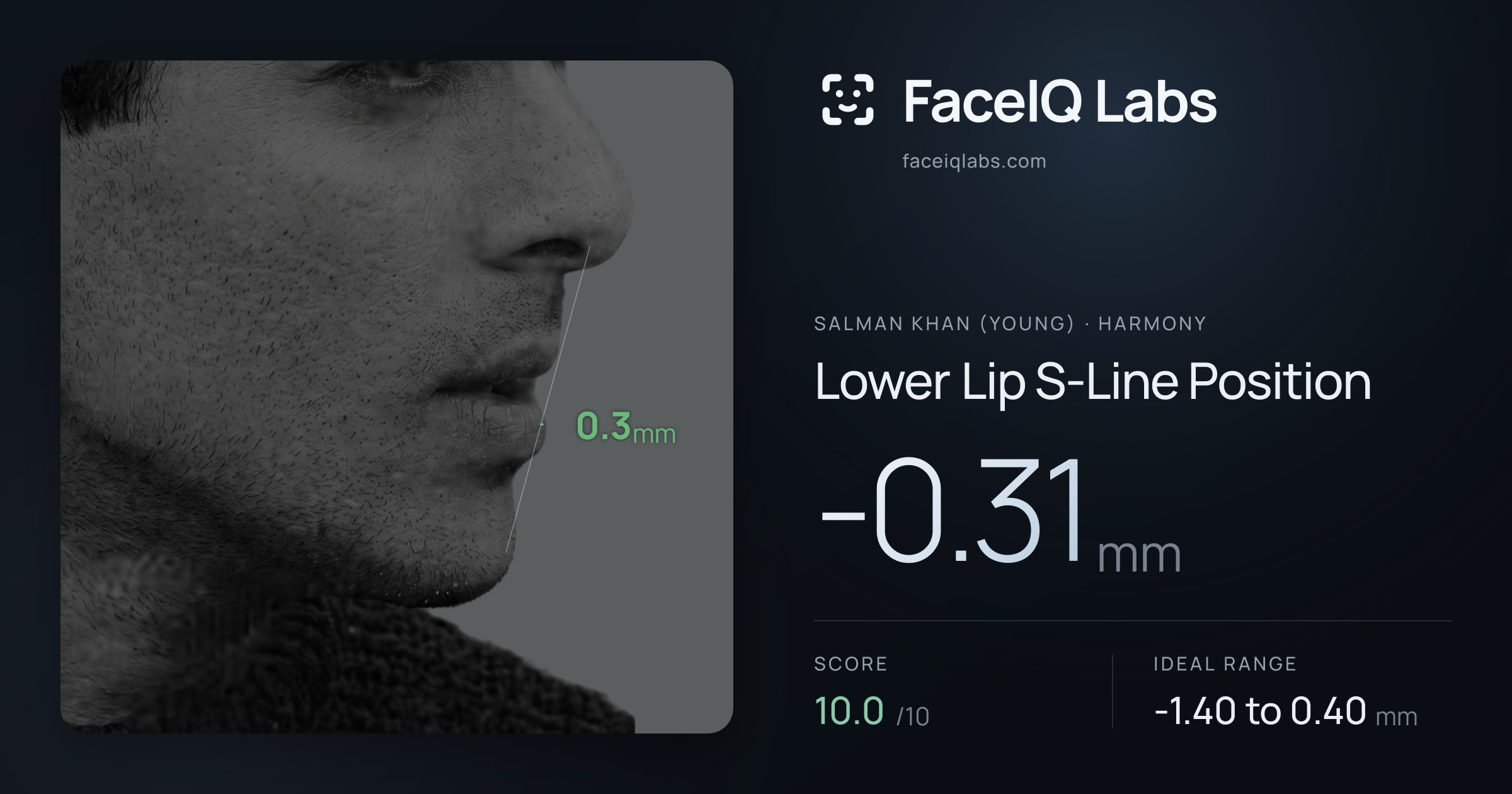 Salman Khan (Young) Lower Lip S-Line Position: -0.31mm, drawn on the photo