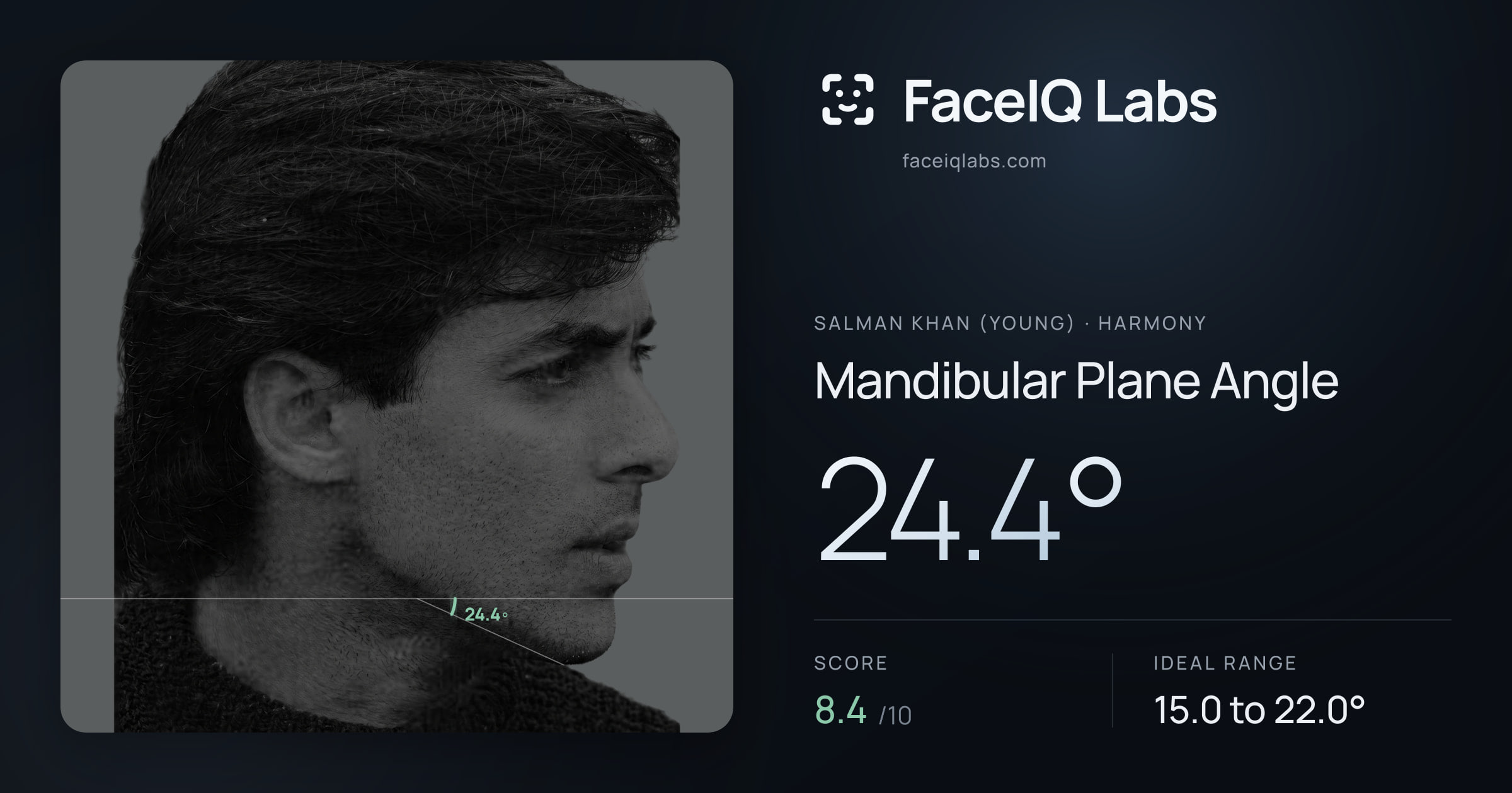 Salman Khan (Young) Mandibular Plane Angle: 24.4°, drawn on the photo
