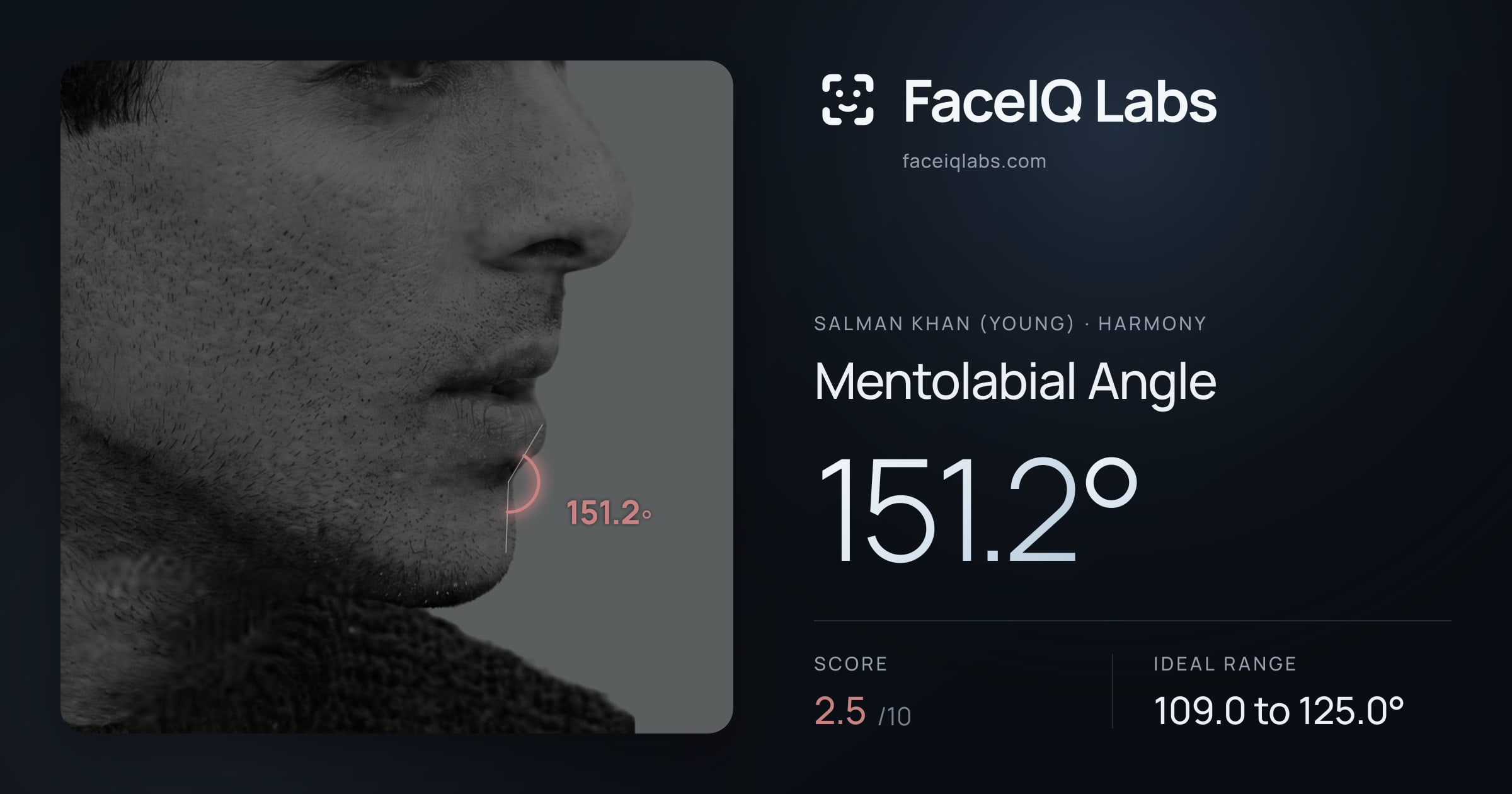 Salman Khan (Young) Mentolabial Angle: 151.2°, drawn on the photo