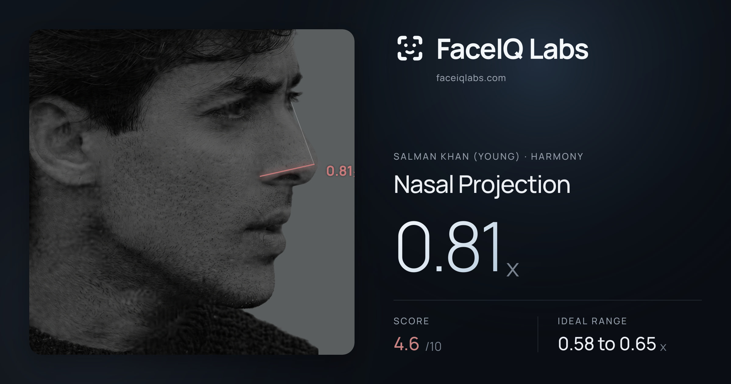 Salman Khan (Young) Nasal Projection: 0.81x, drawn on the photo